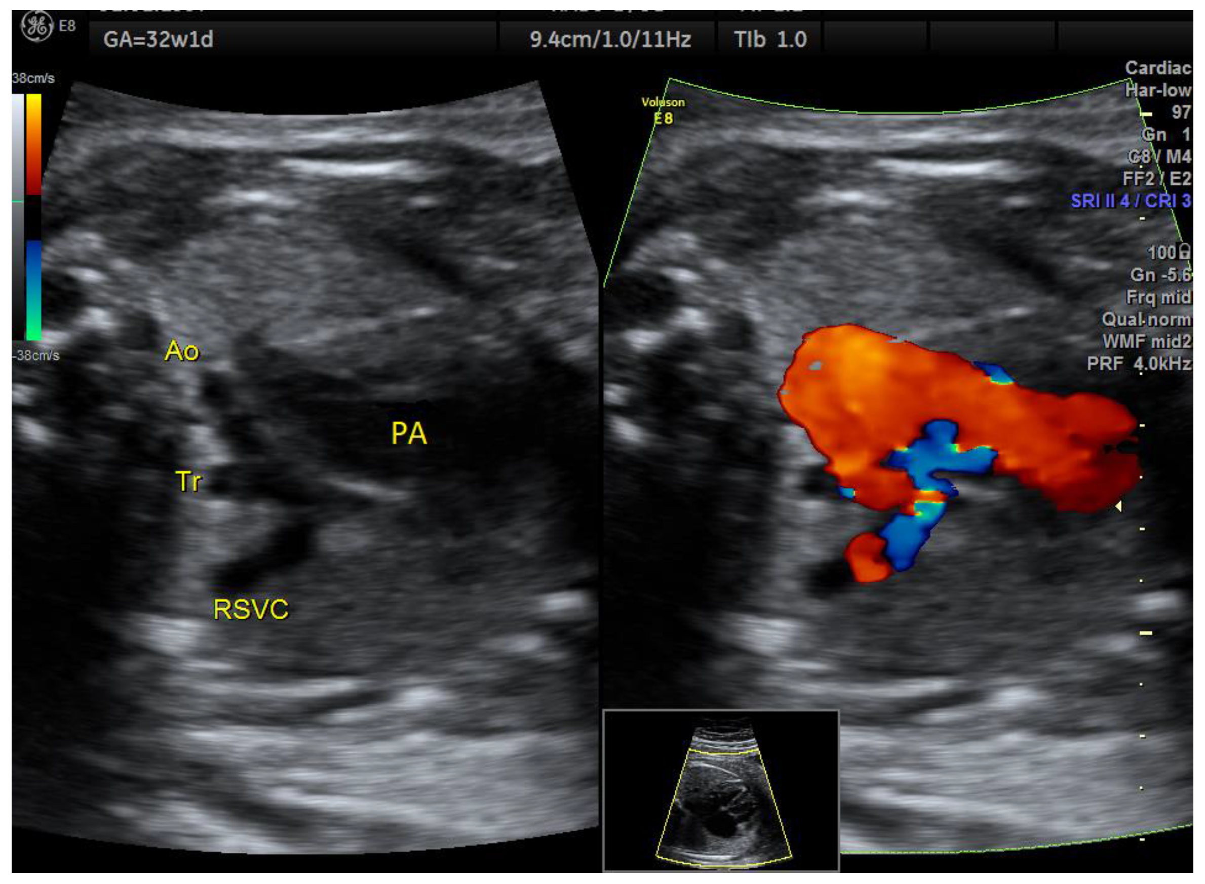 Medicina 58 00262 g005