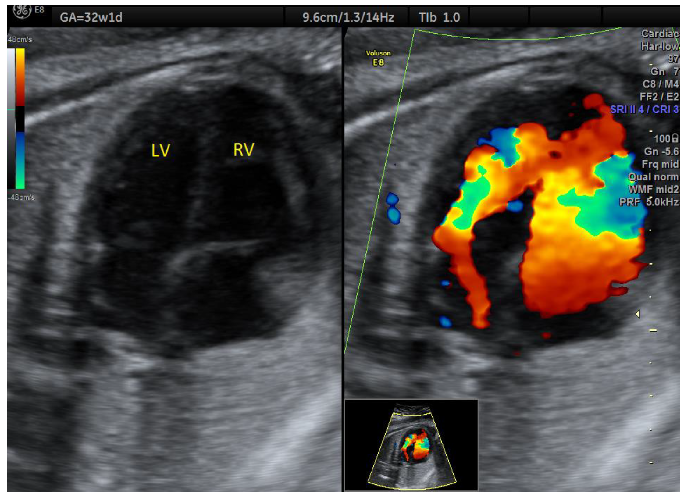 Medicina 58 00262 g006