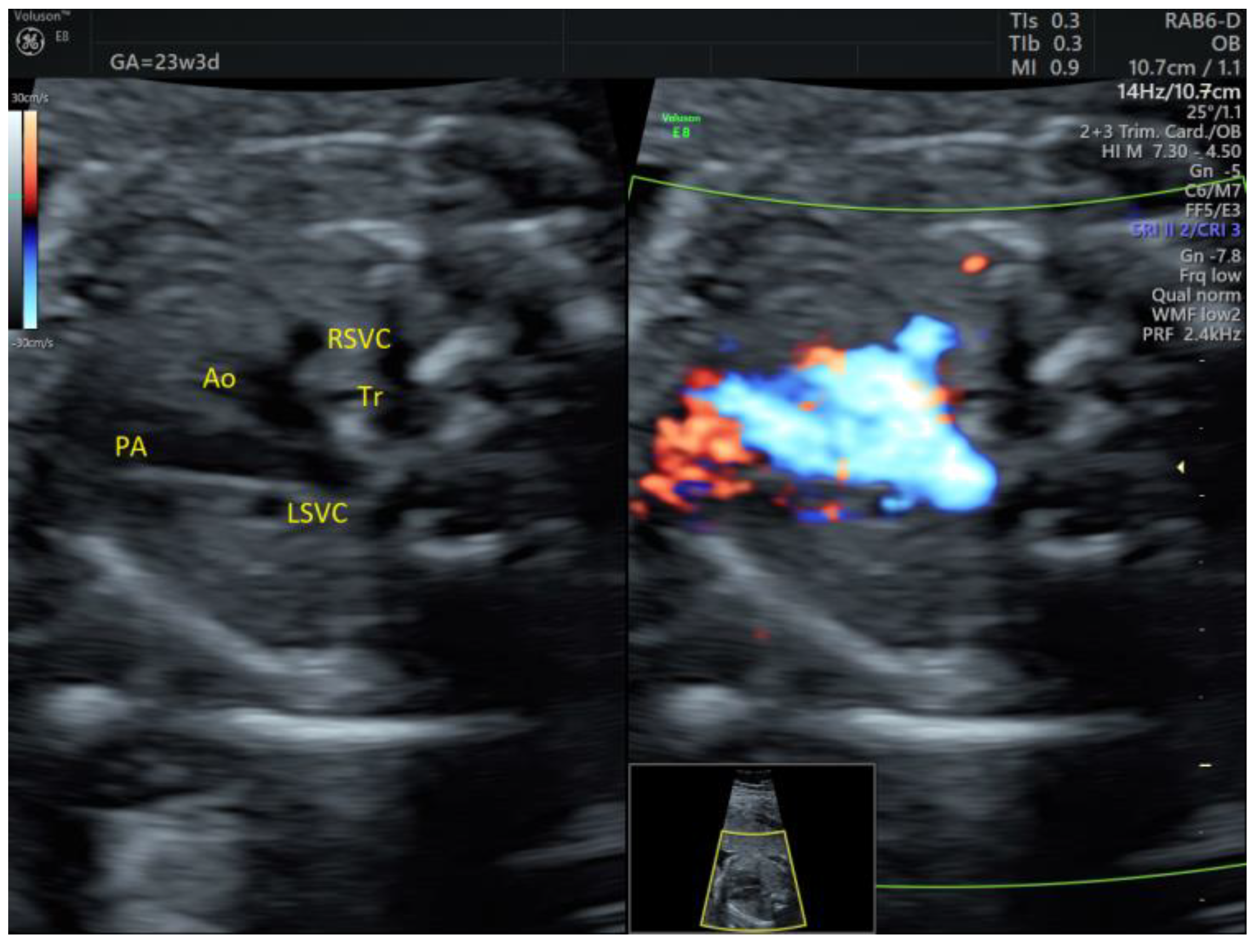 Medicina 58 00262 g011