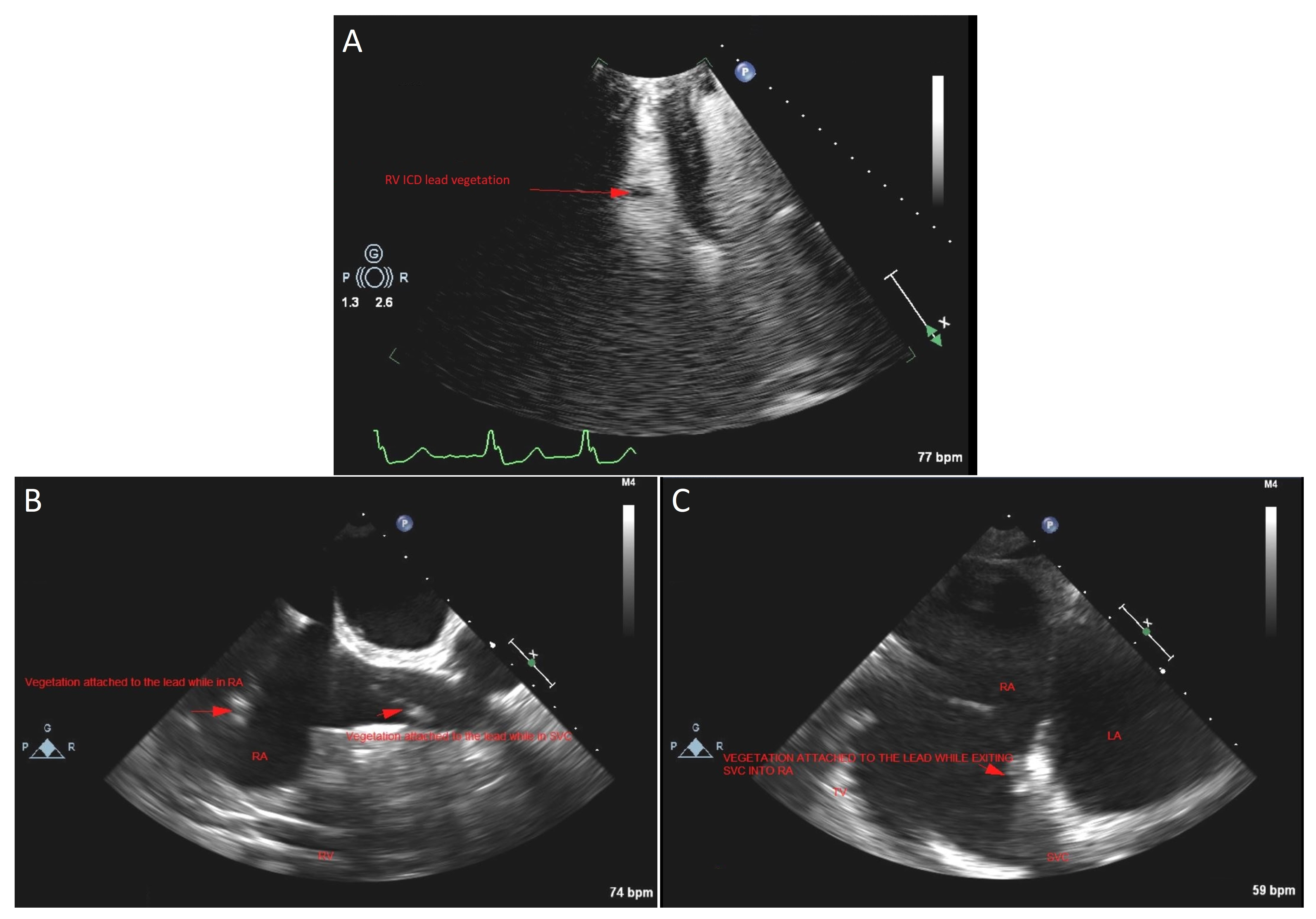 Medicina 58 00307 g002