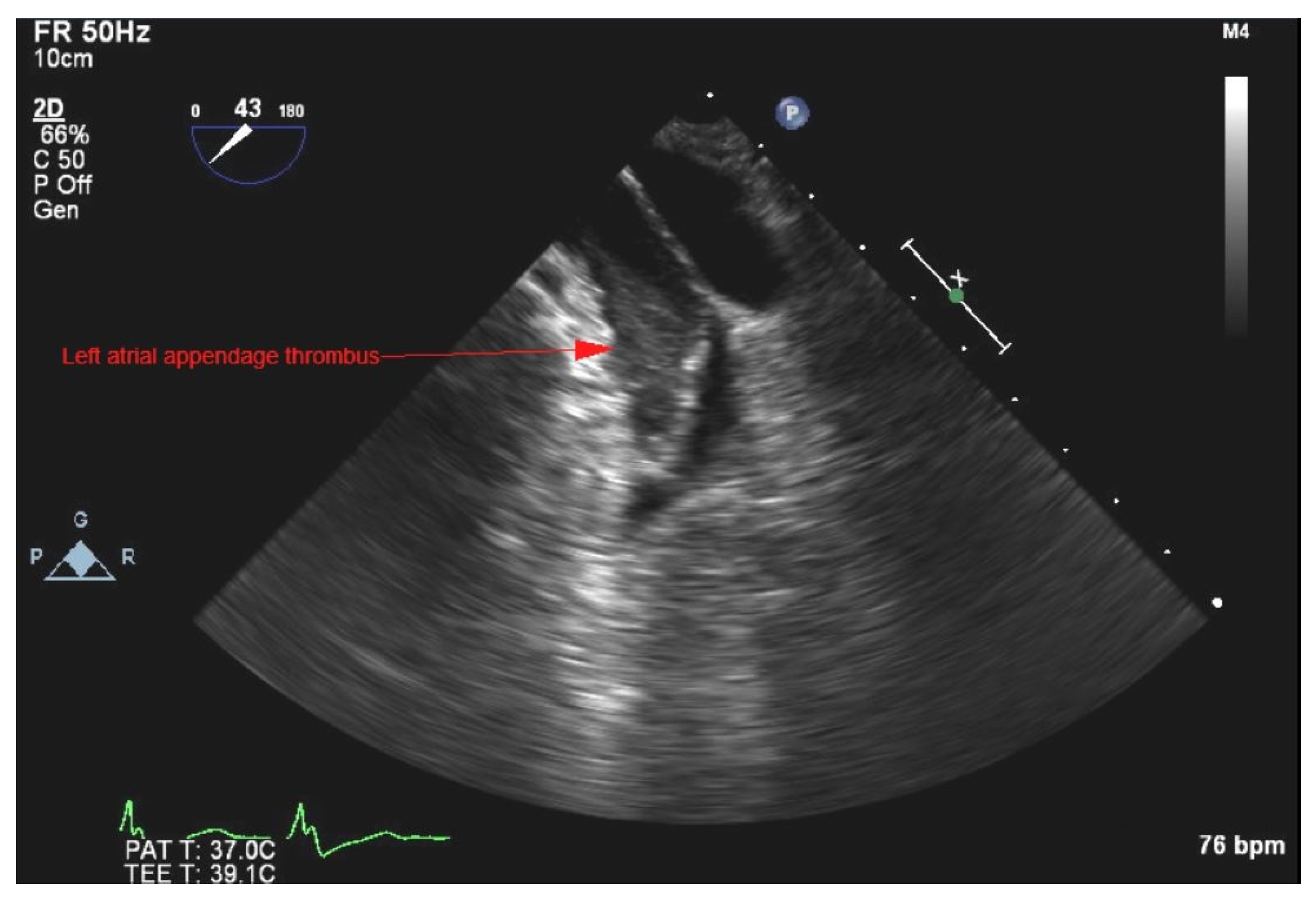 Medicina 58 00307 g004