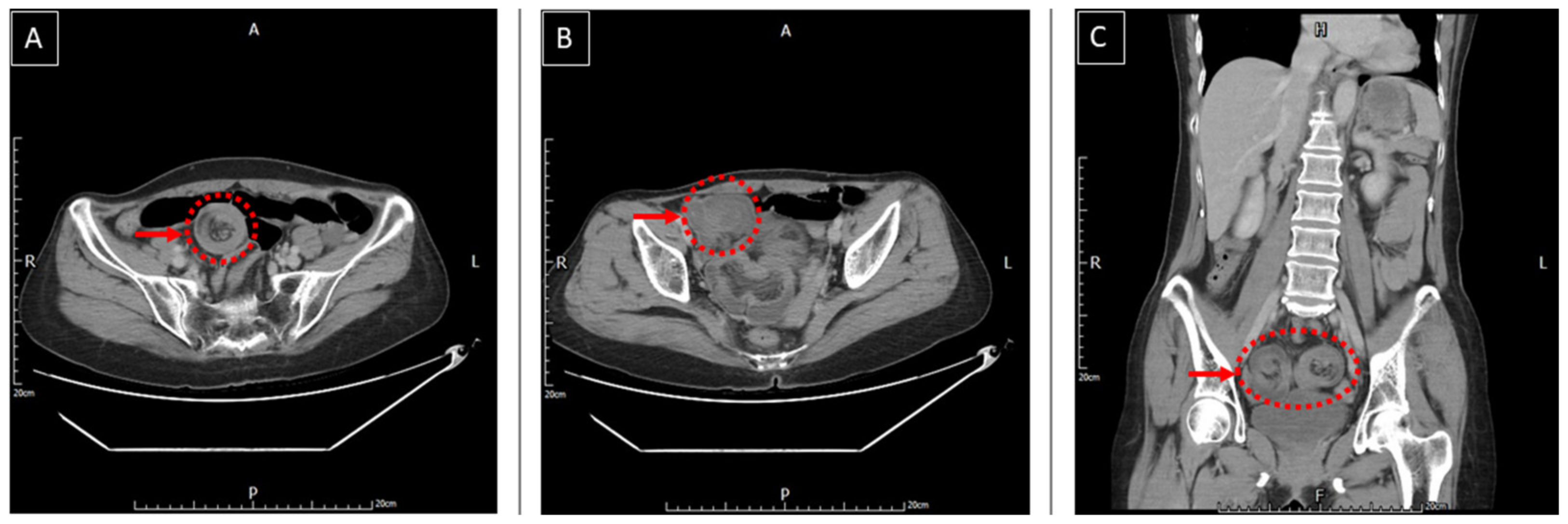 Medicina 58 00310 g002