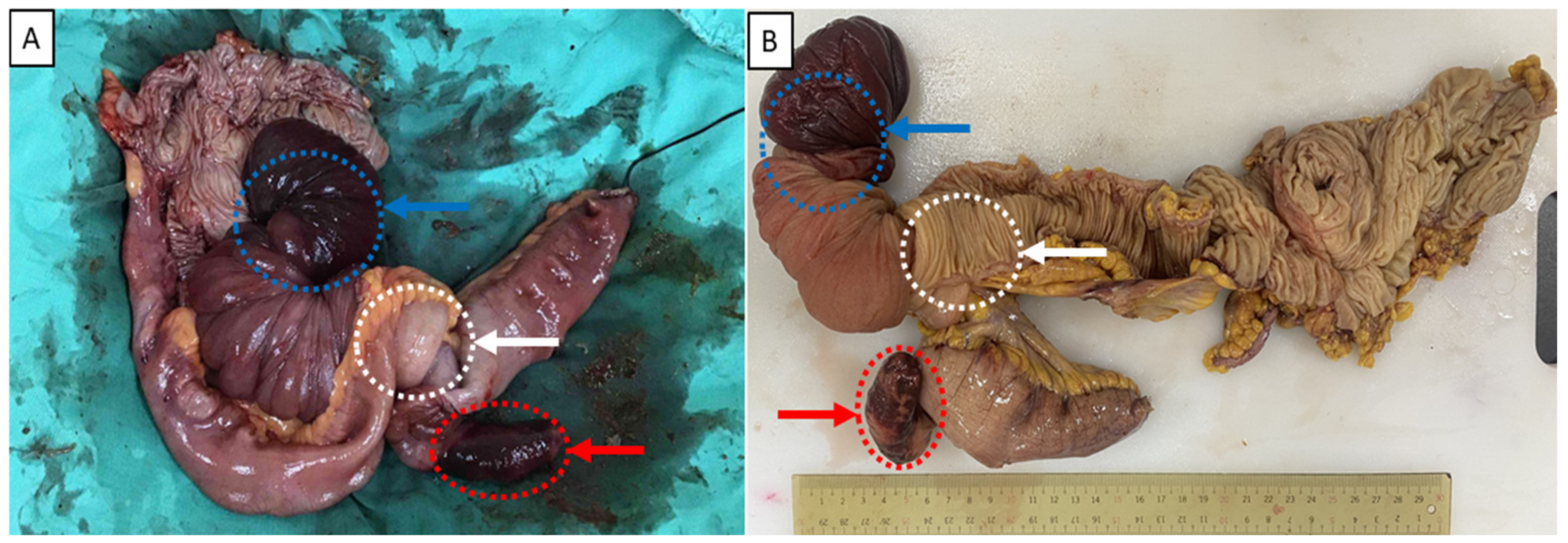 Medicina 58 00310 g003