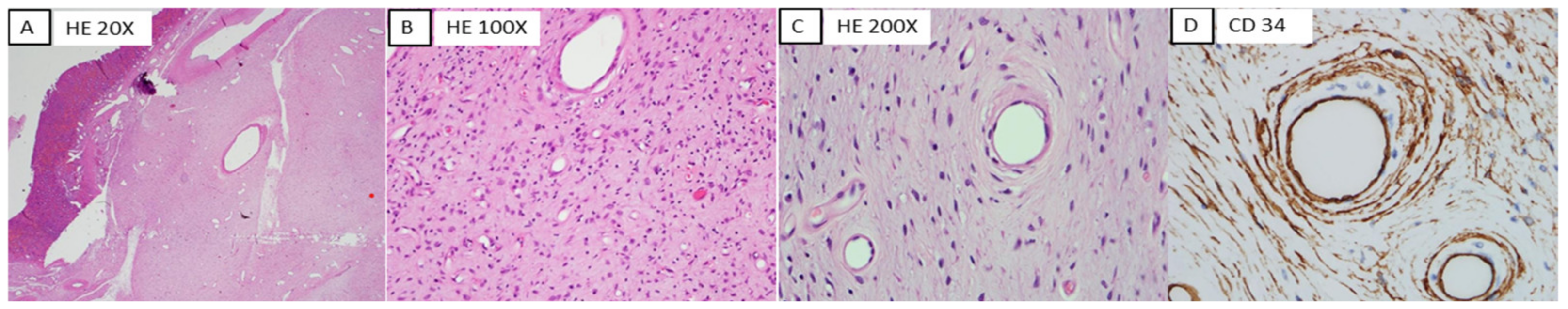 Medicina 58 00310 g004