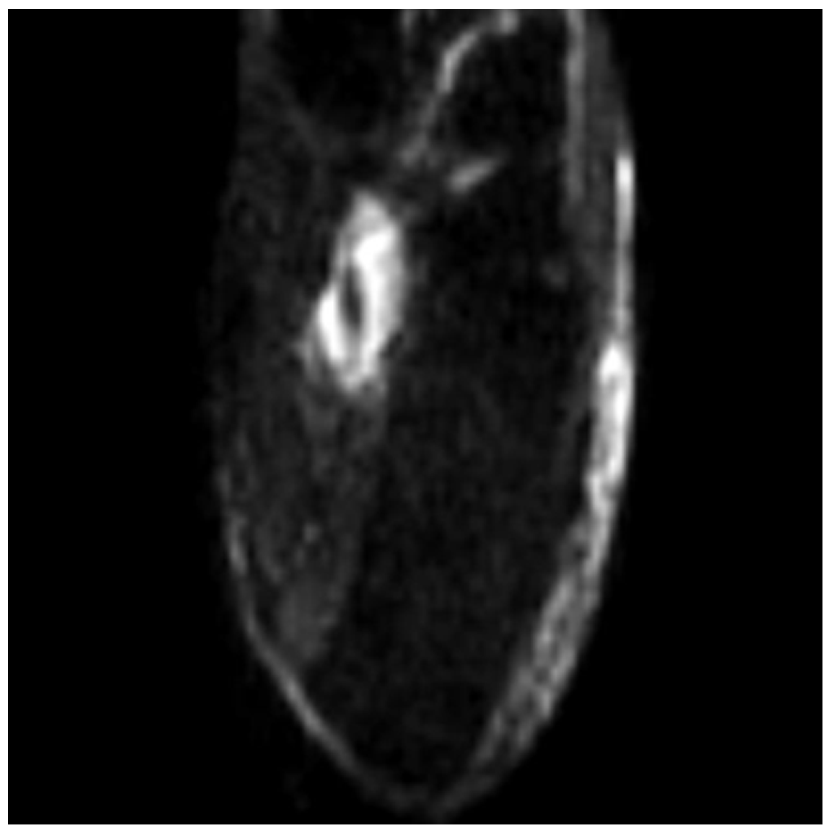 Medicina 58 00321 g004