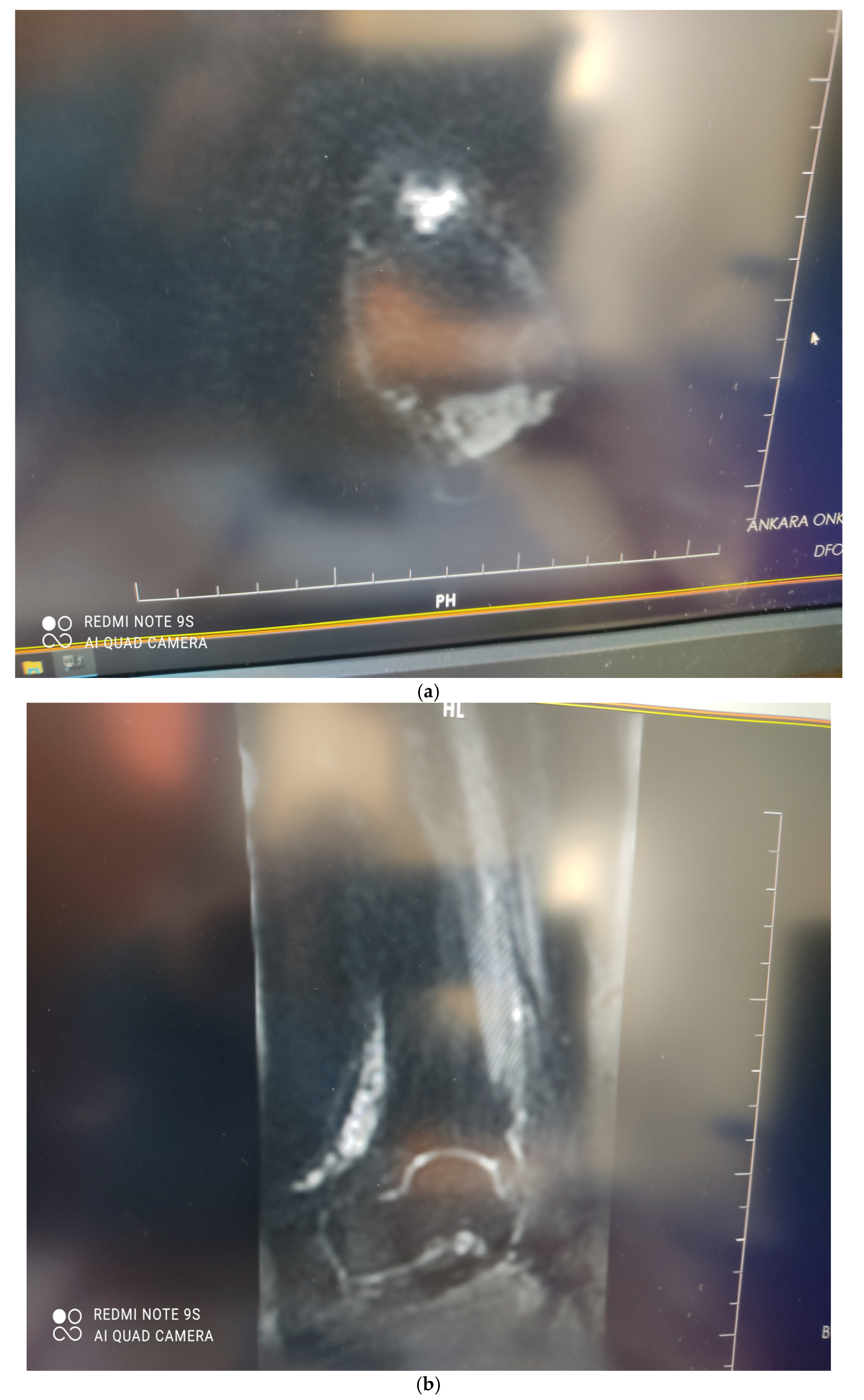 Medicina 58 00321 g005a