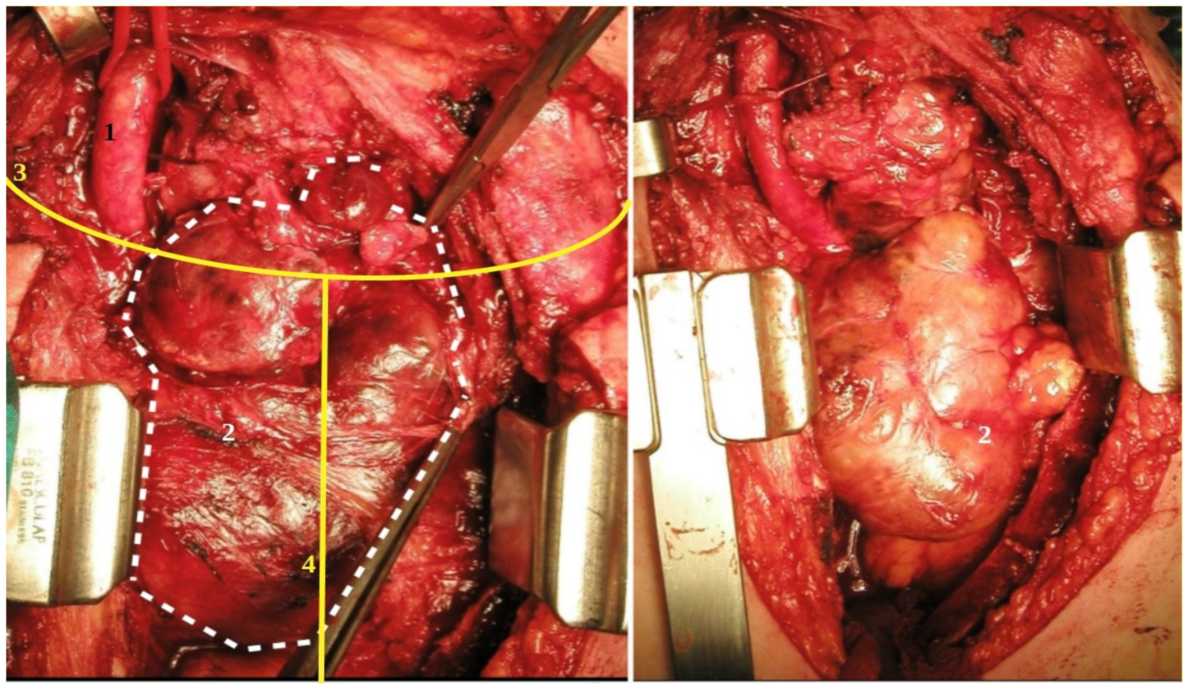Medicina 58 00349 g003