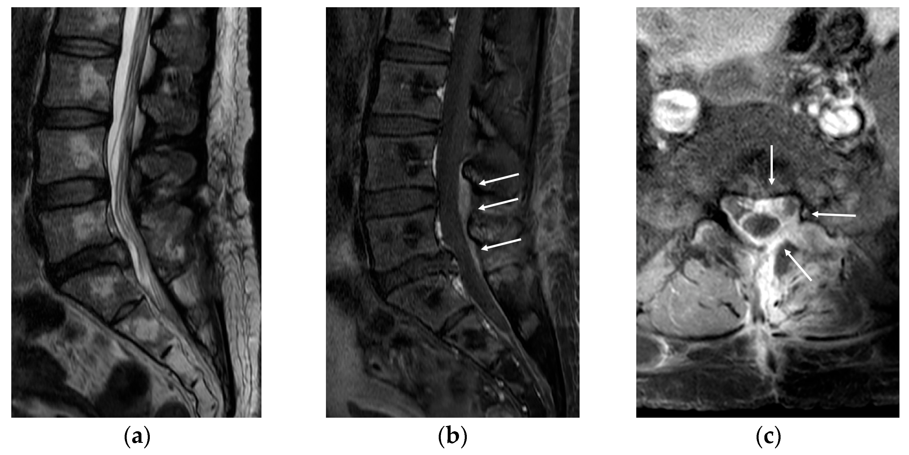 Medicina 58 00371 g002