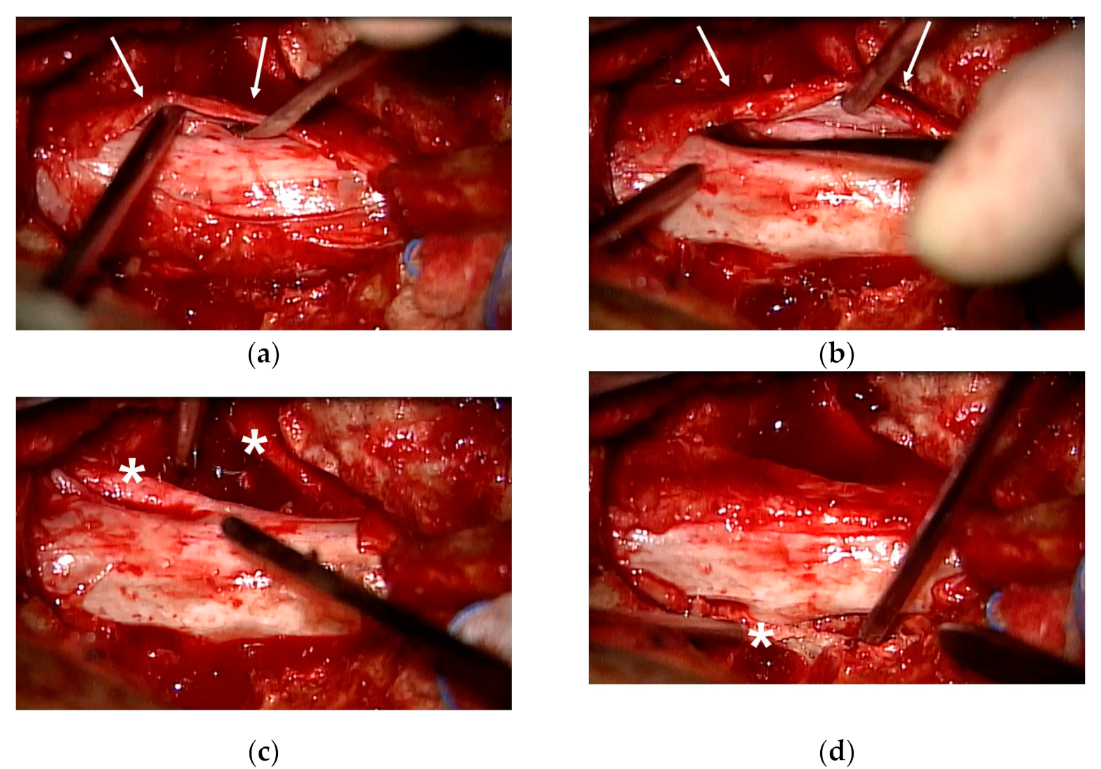 Medicina 58 00371 g003