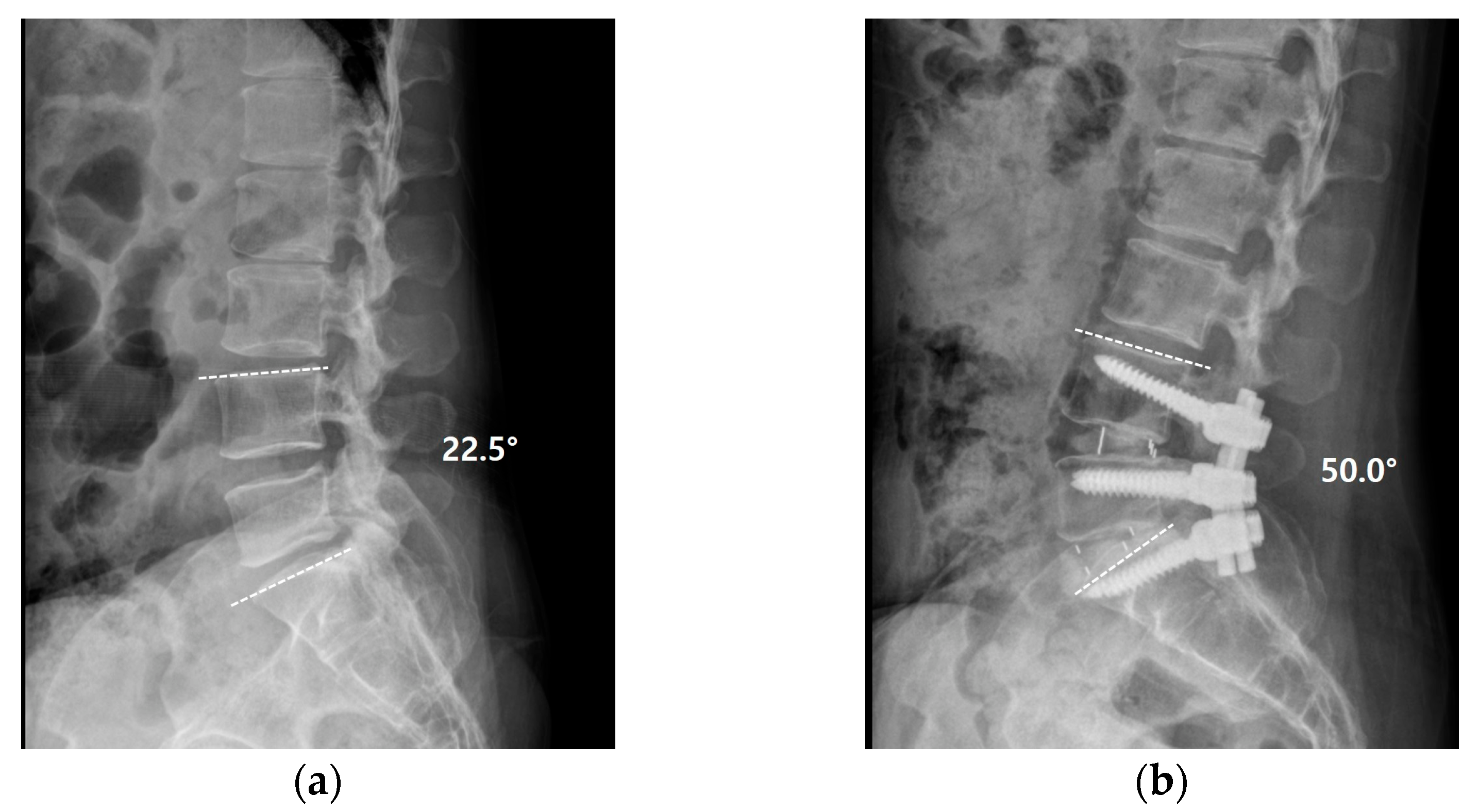 Medicina 58 00371 g004