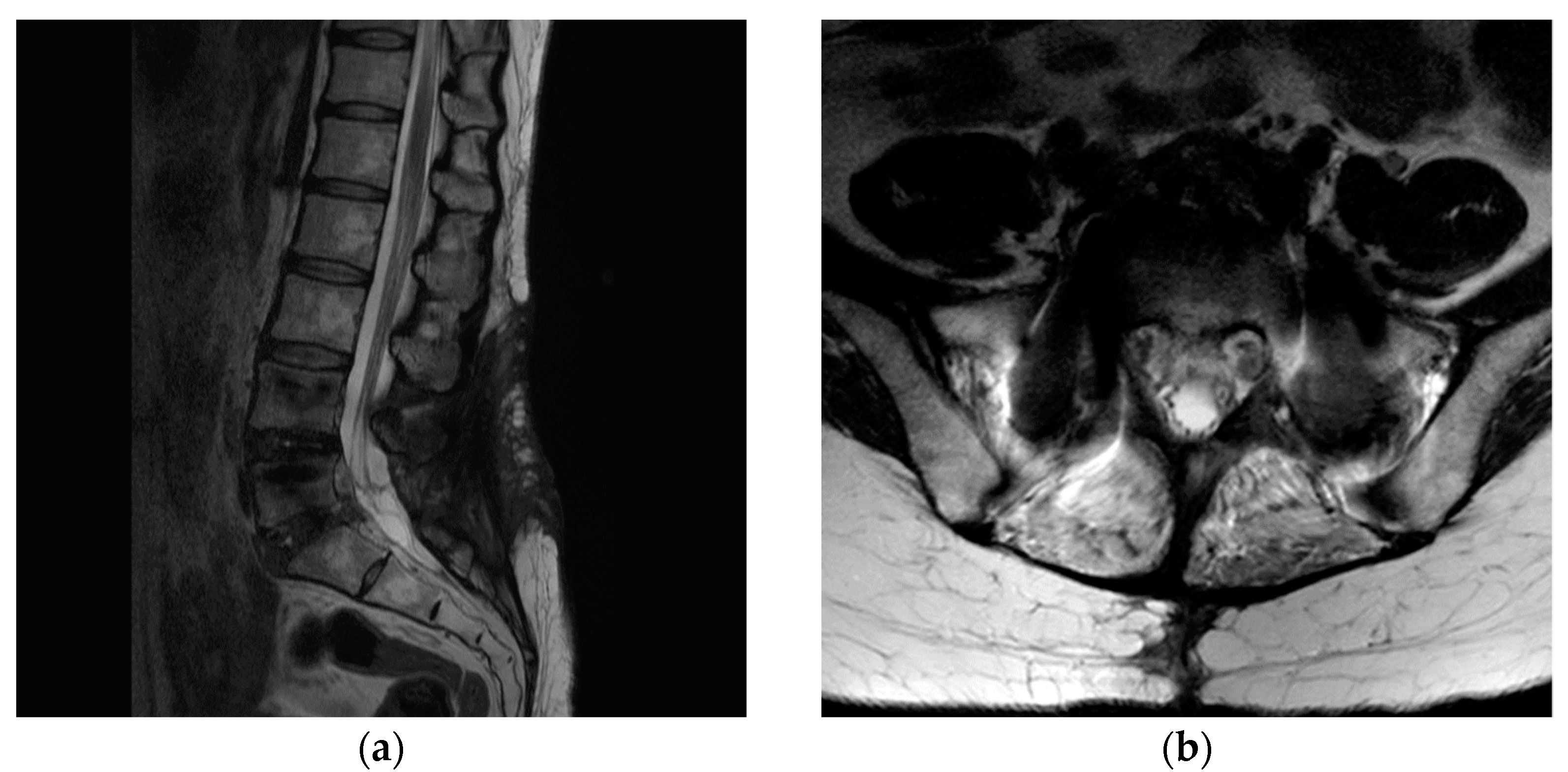 Medicina 58 00371 g005