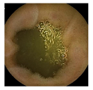 Medicina 58 00397 i042