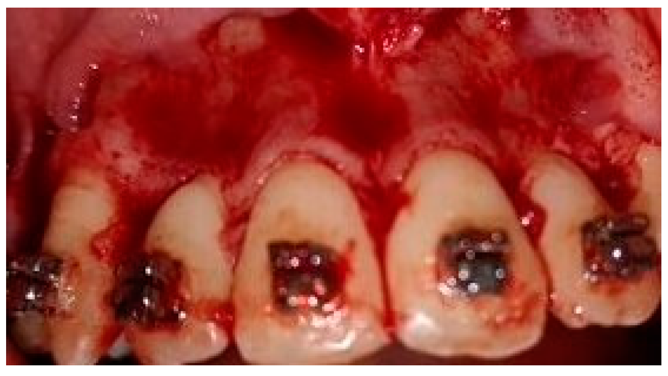 Medicina 58 00468 g001