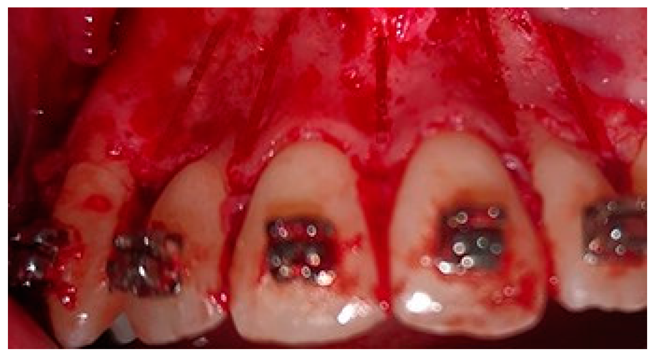 Medicina 58 00468 g002