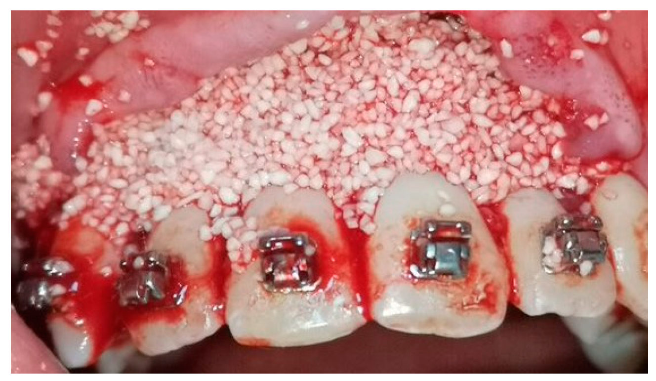 Medicina 58 00468 g003