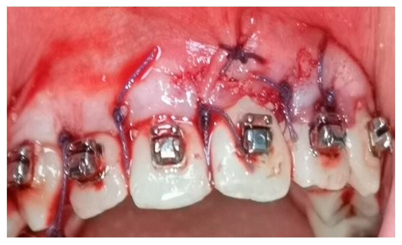 Medicina 58 00468 g004