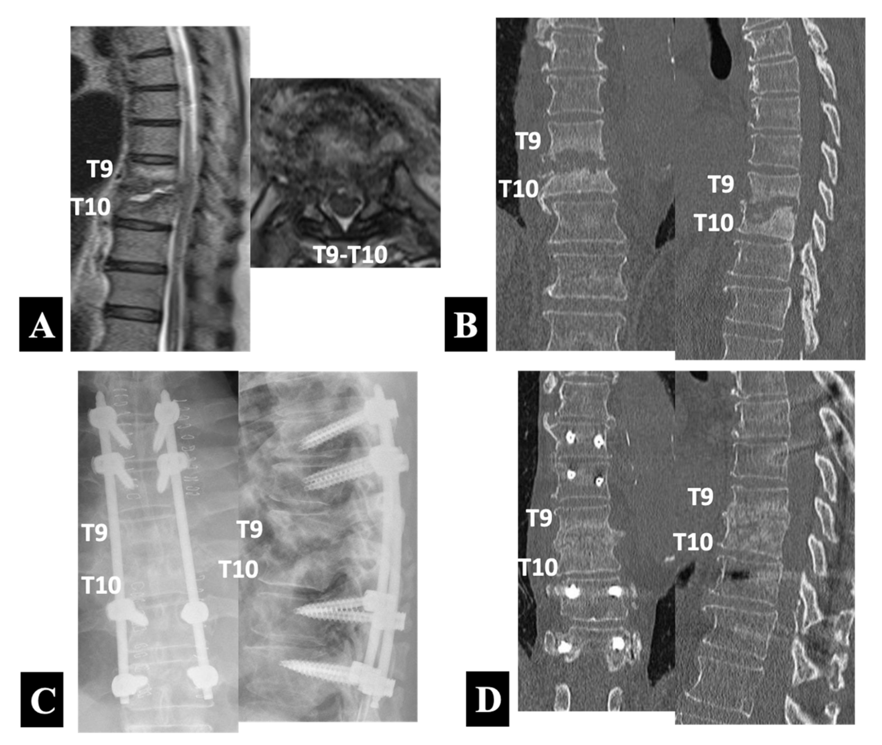 Medicina 58 00478 g003
