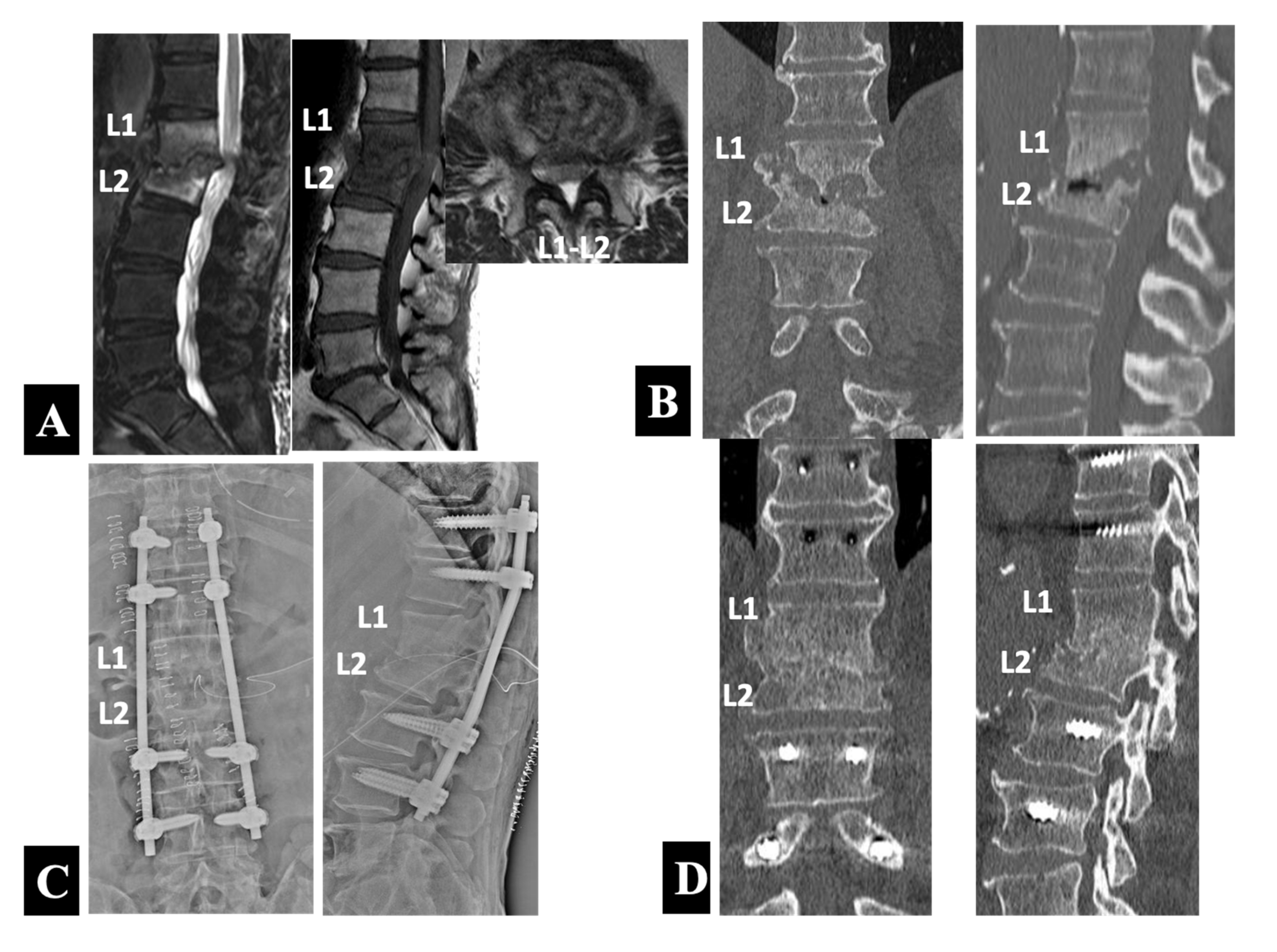 Medicina 58 00478 g004