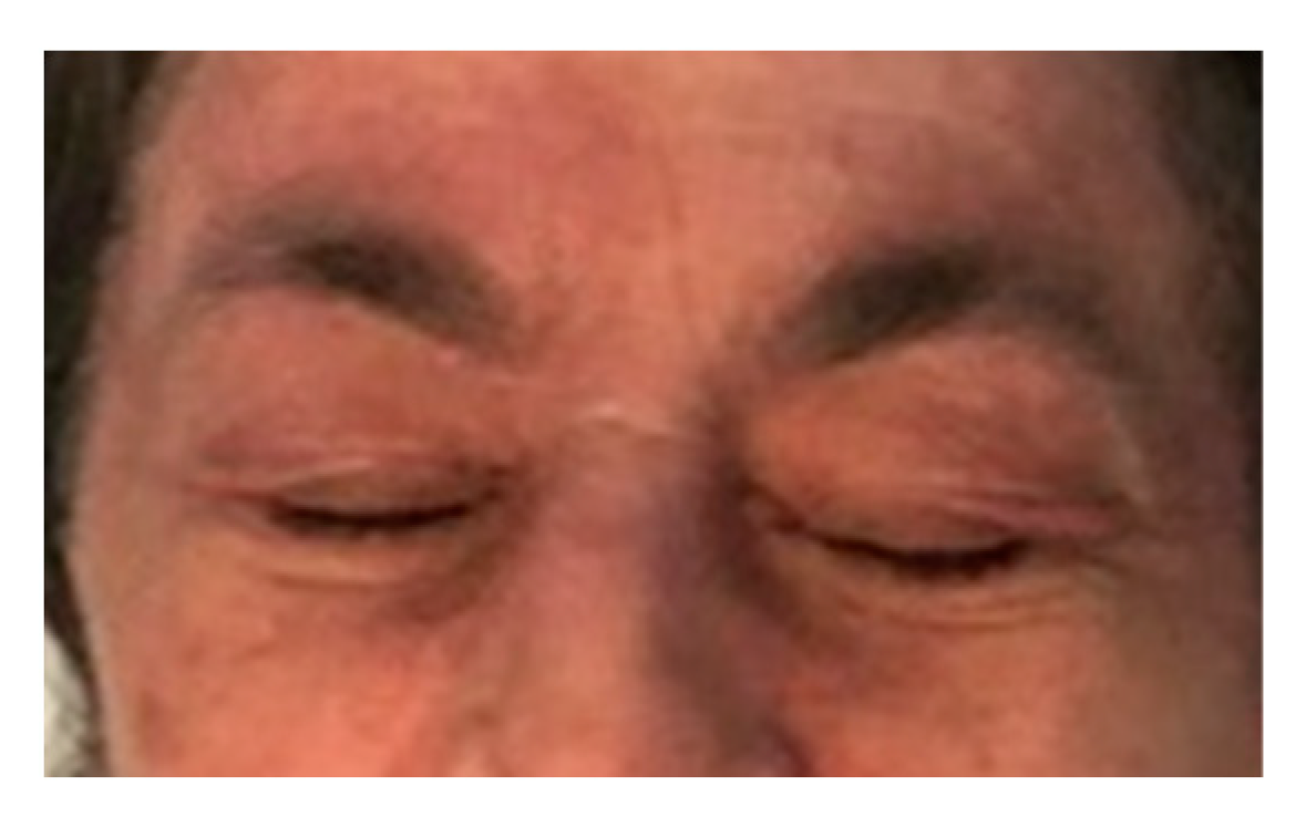 Medicina 58 00484 g002