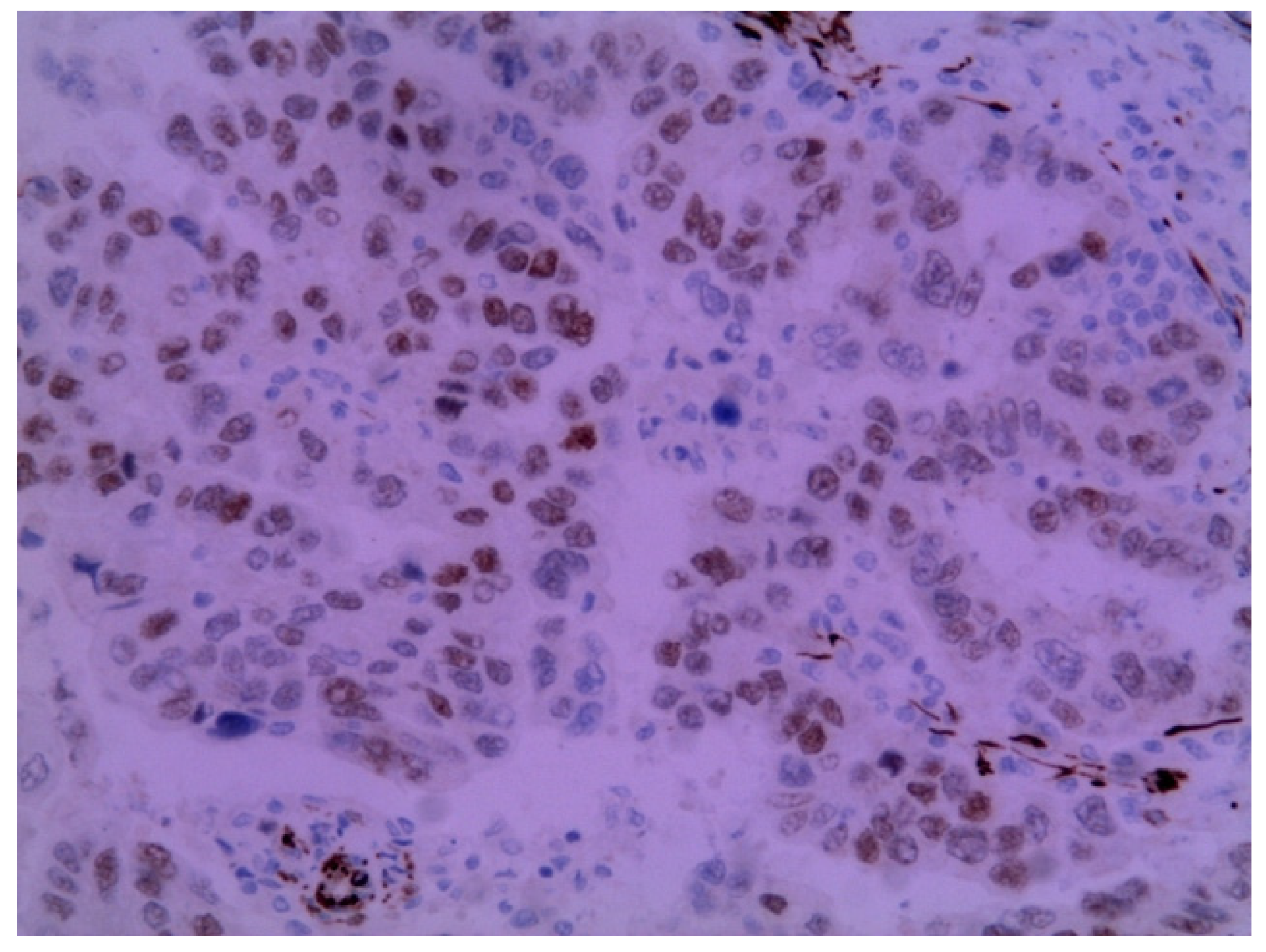 Medicina 58 00592 g004