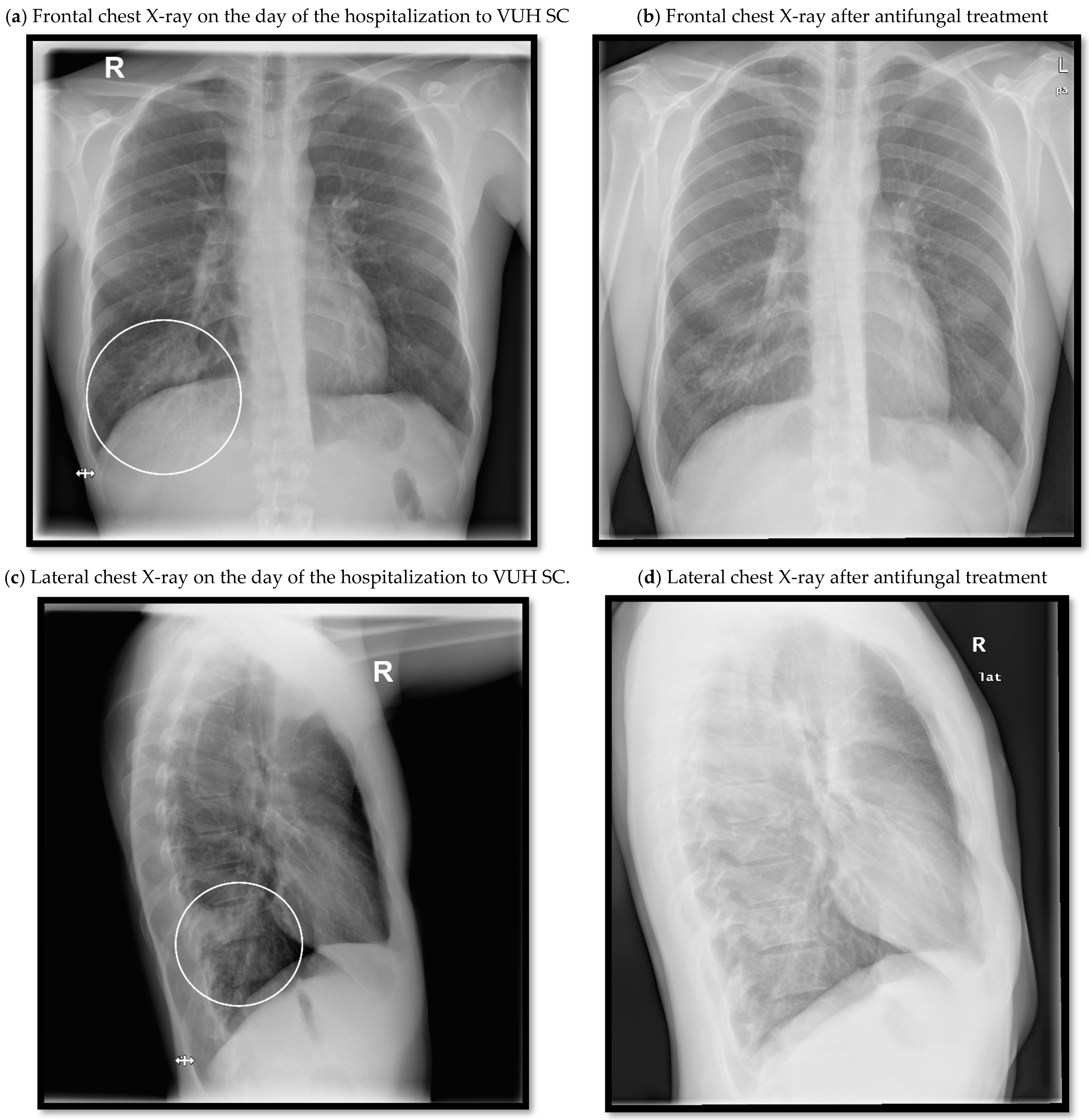 Medicina 58 00655 g002