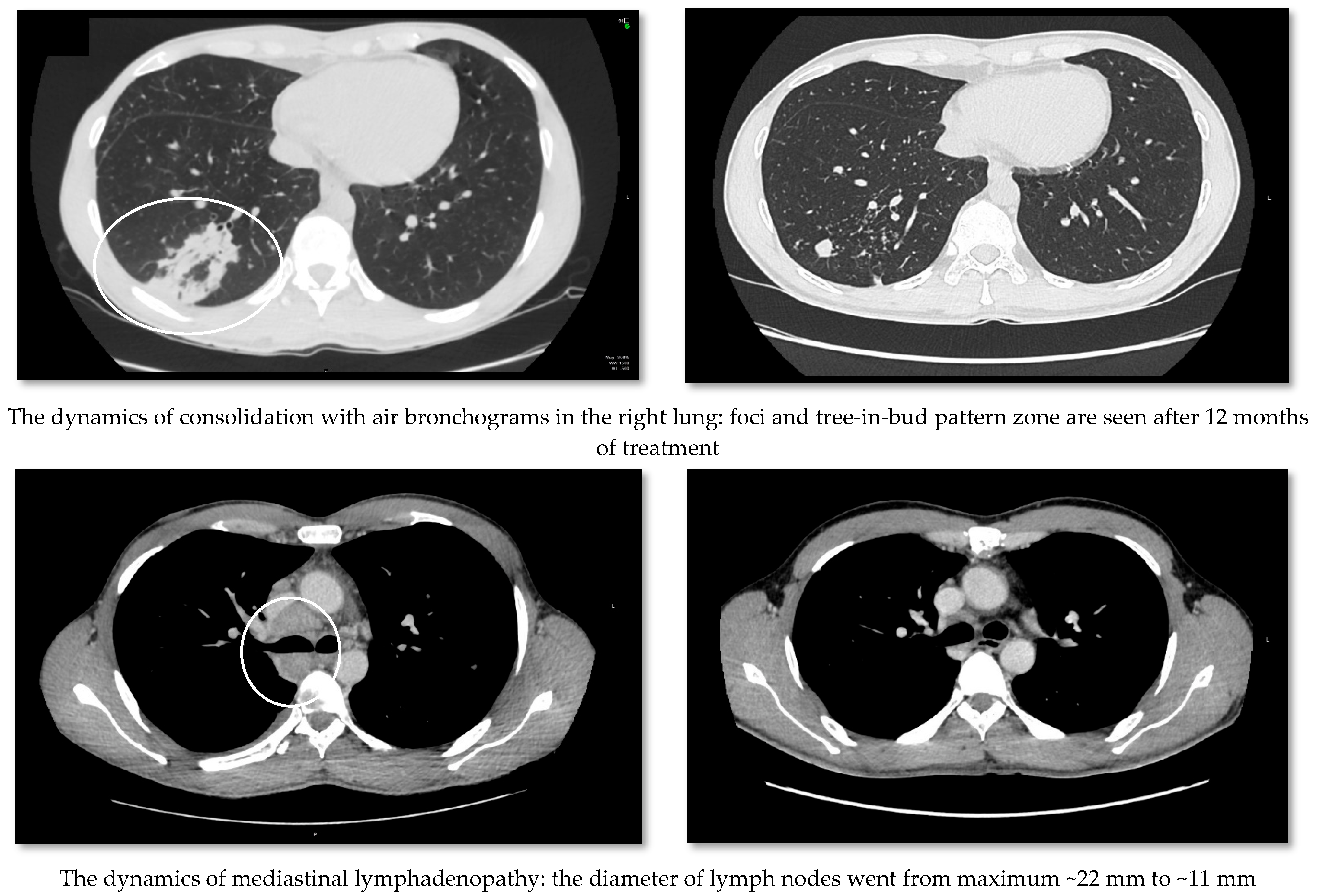 Medicina 58 00655 g004b