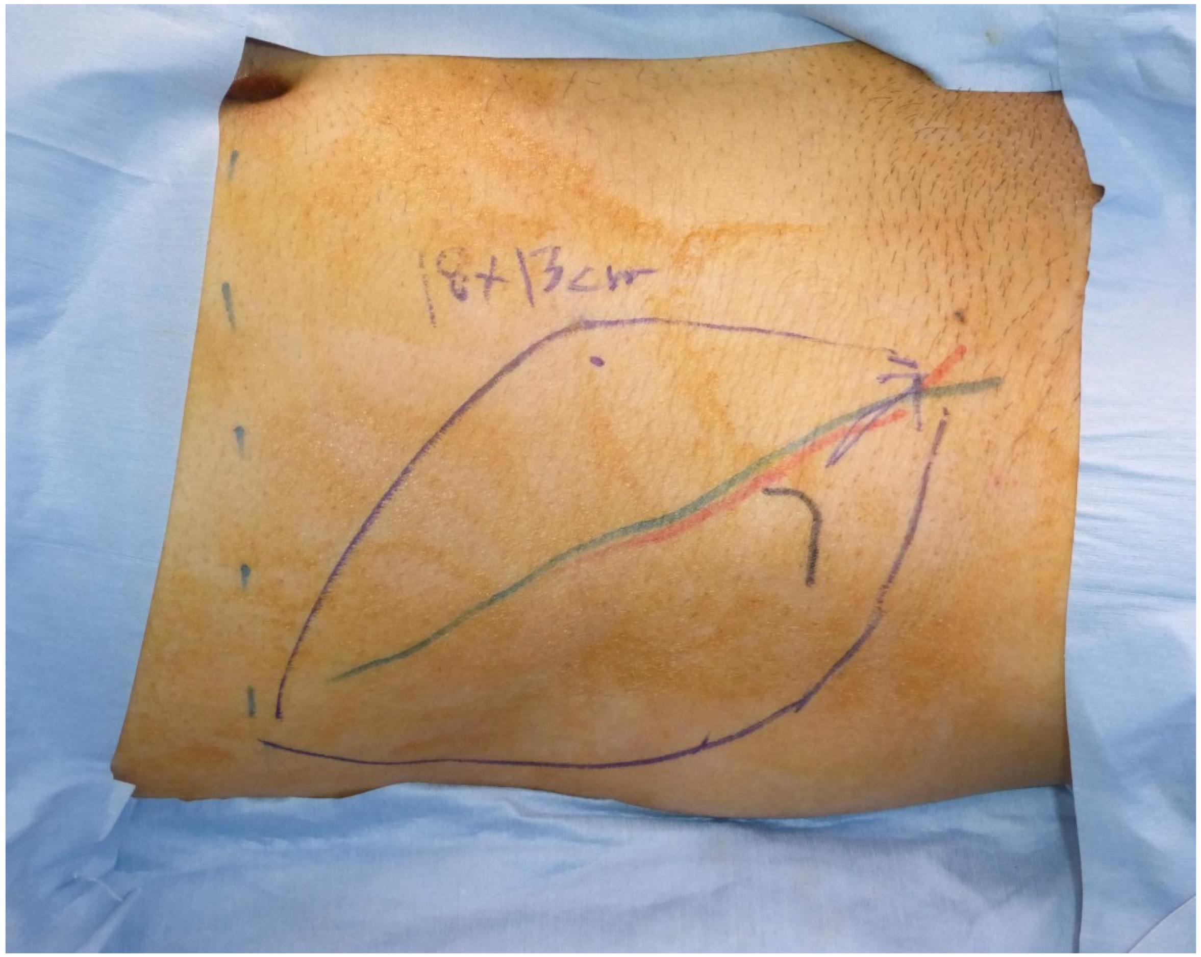 Medicina 58 00670 g002
