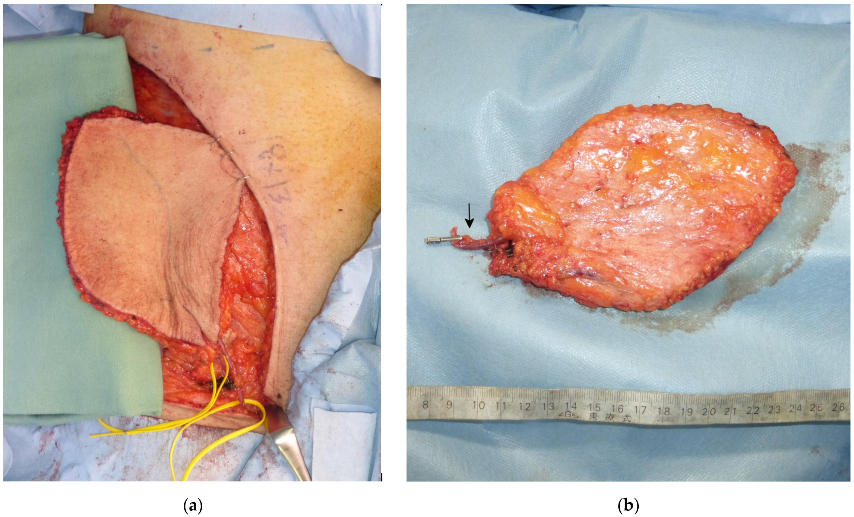 Medicina 58 00670 g003
