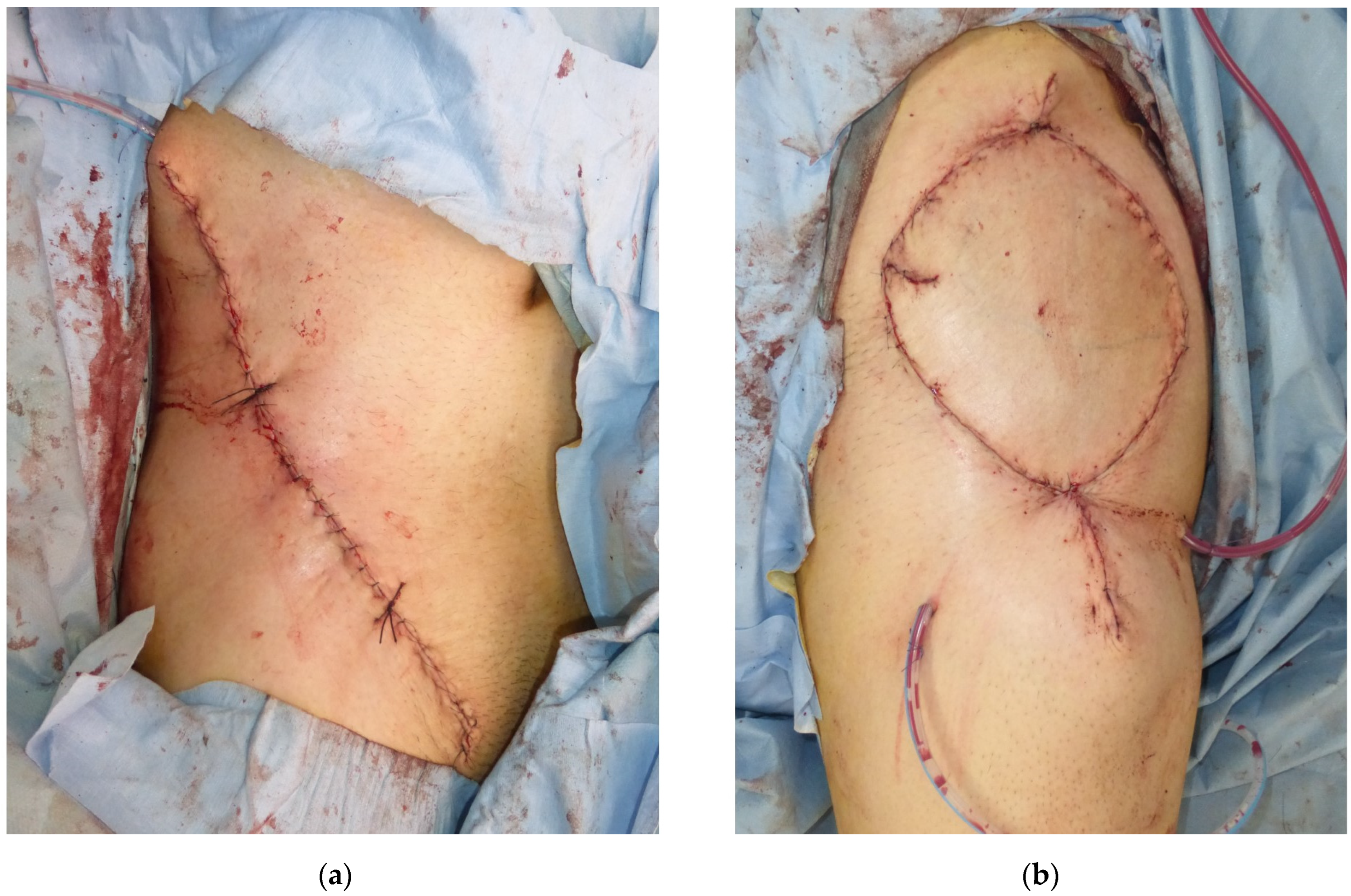 Medicina 58 00670 g004