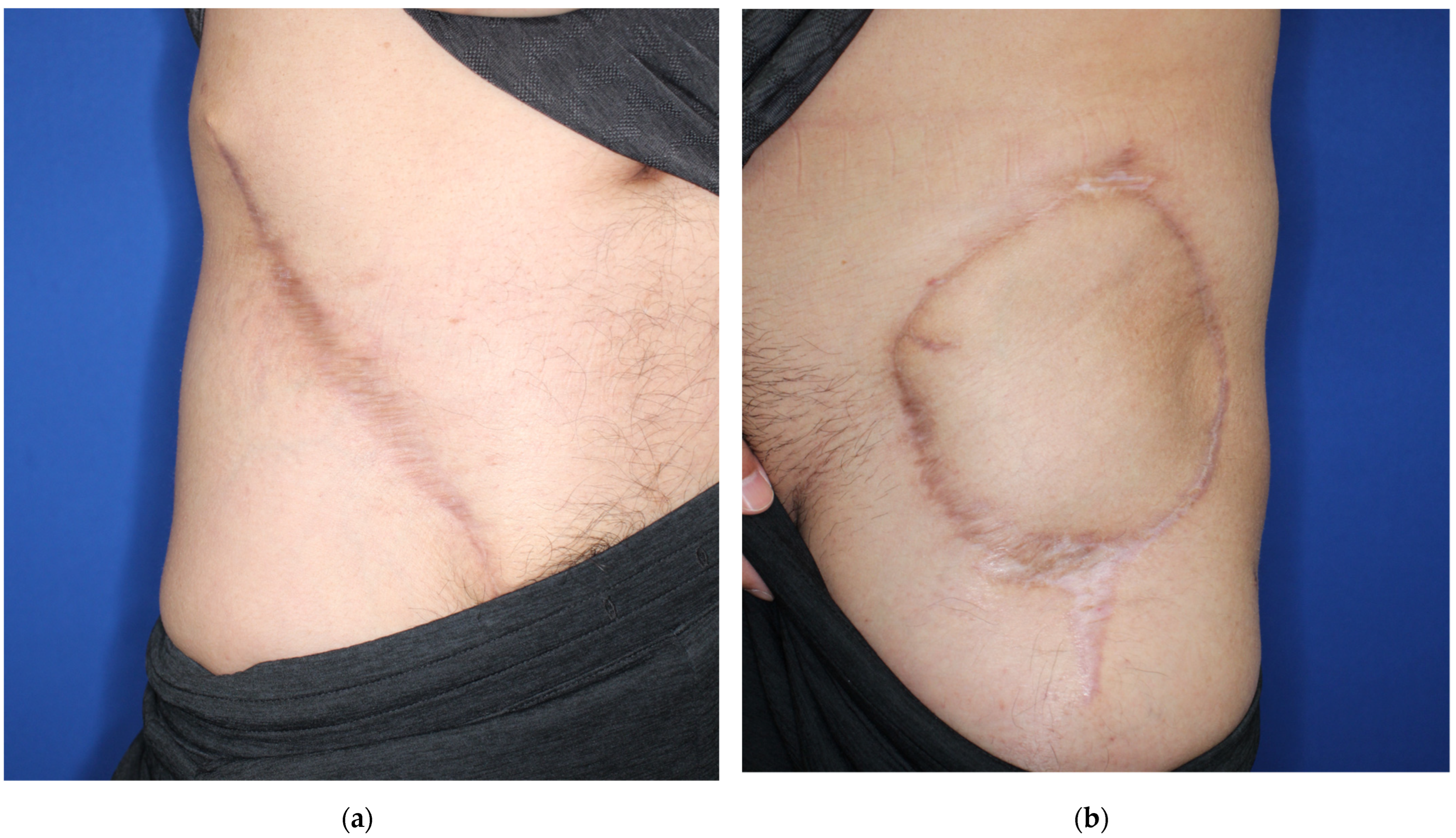 Medicina 58 00670 g005