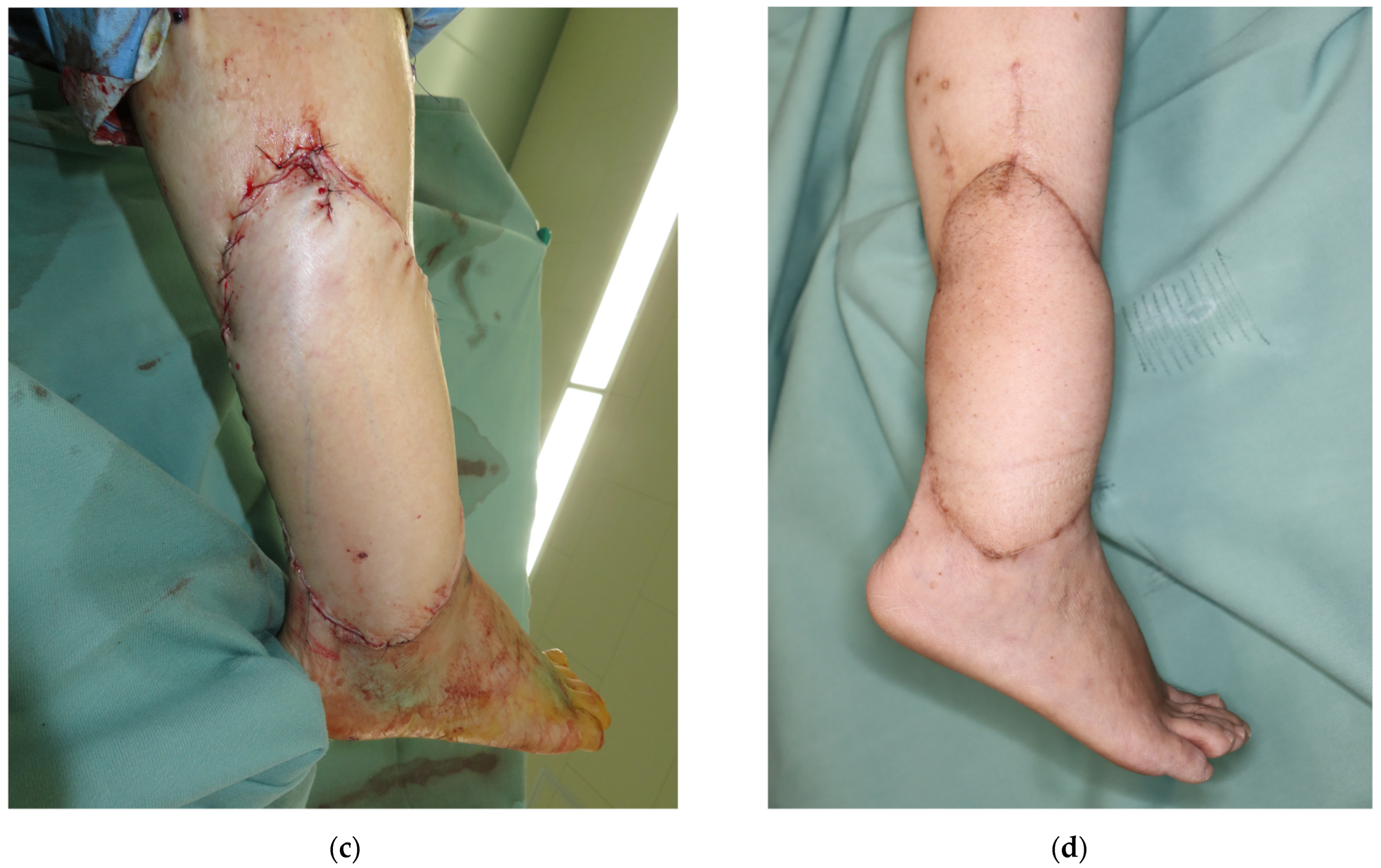 Medicina 58 00670 g006b