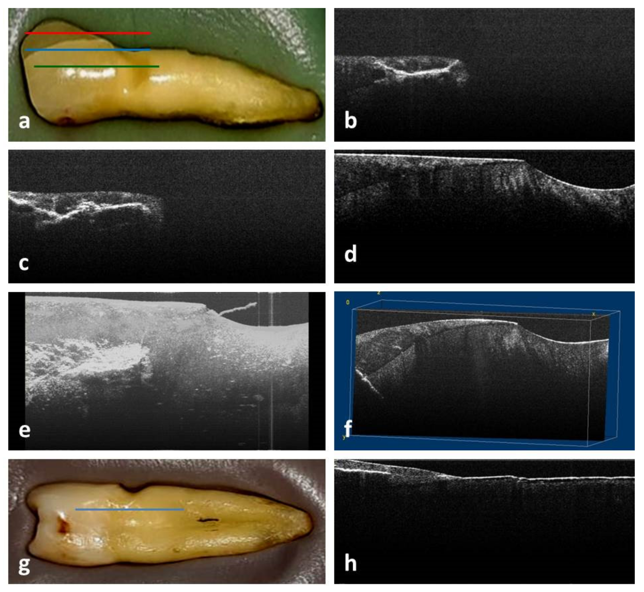 Medicina 58 00702 g001