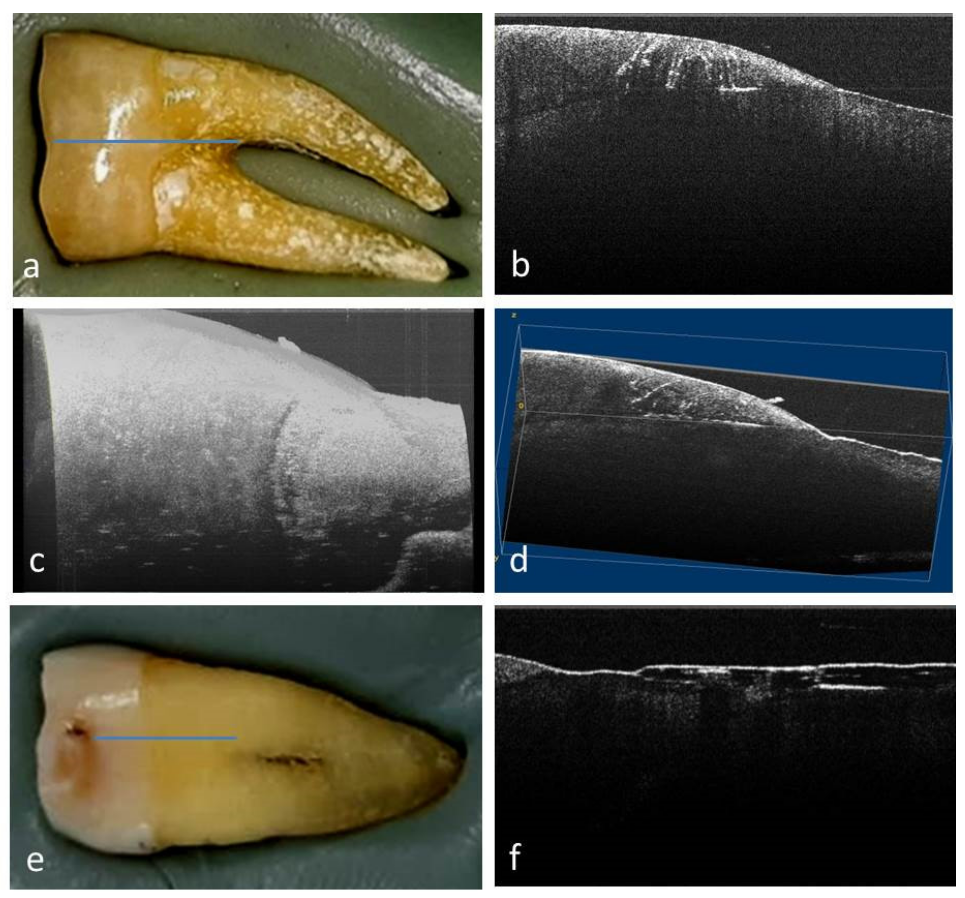 Medicina 58 00702 g003
