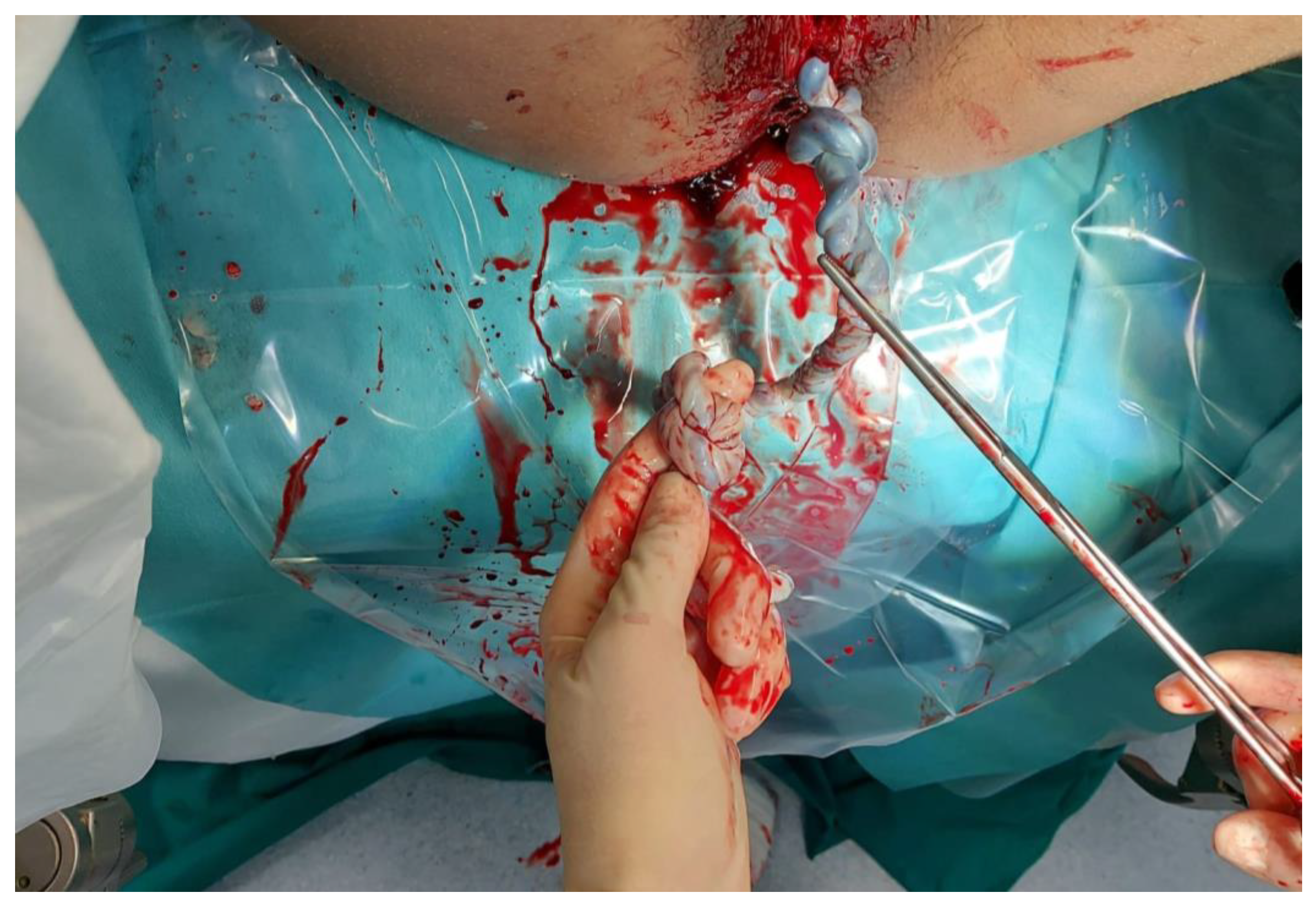 Medicina 58 00703 g001