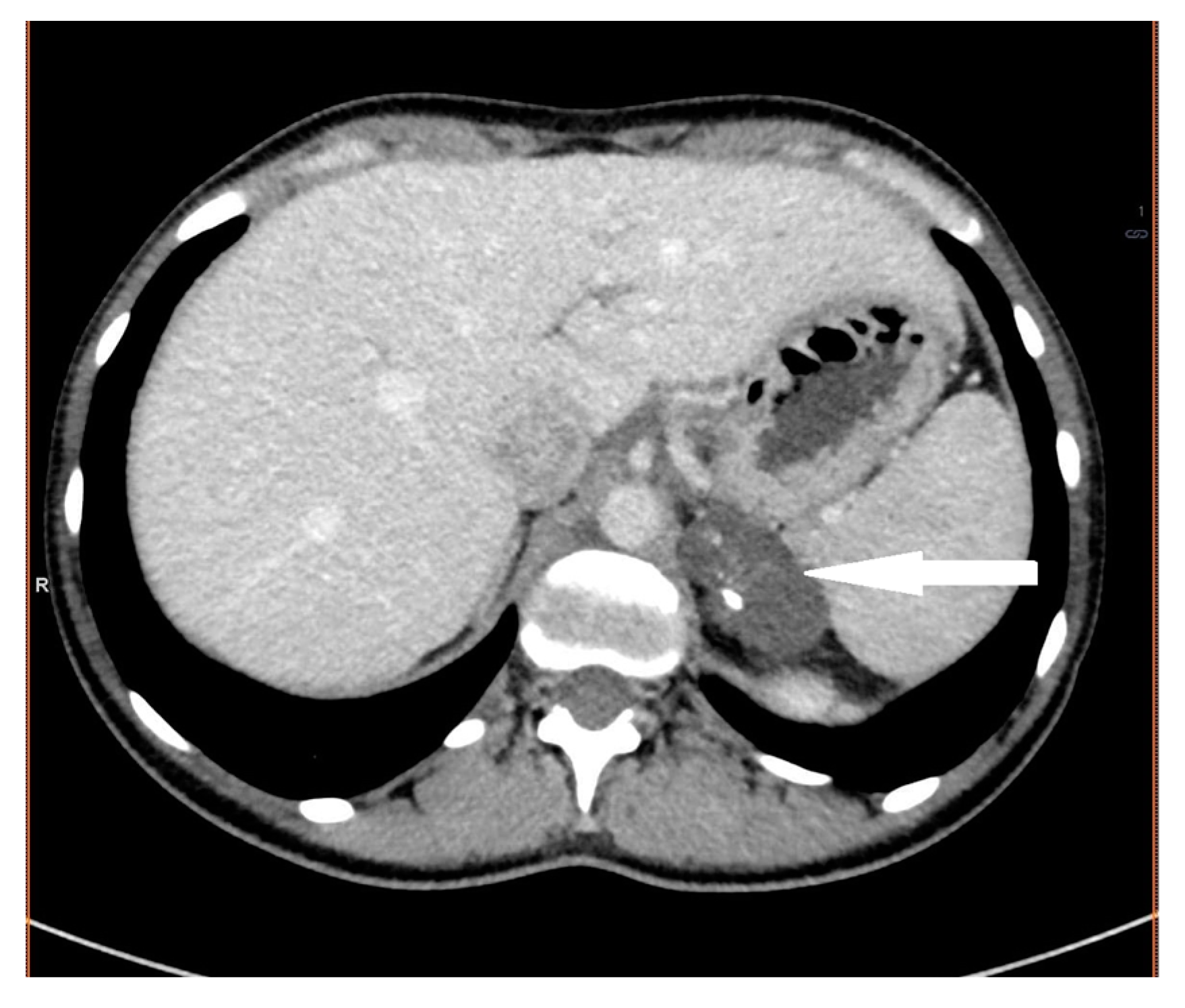 Medicina 58 00746 g005