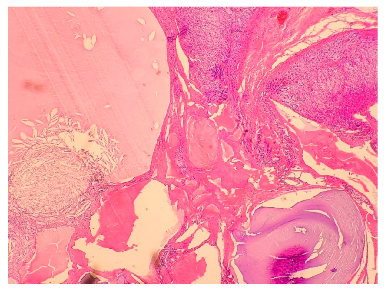 Medicina 58 00746 g006