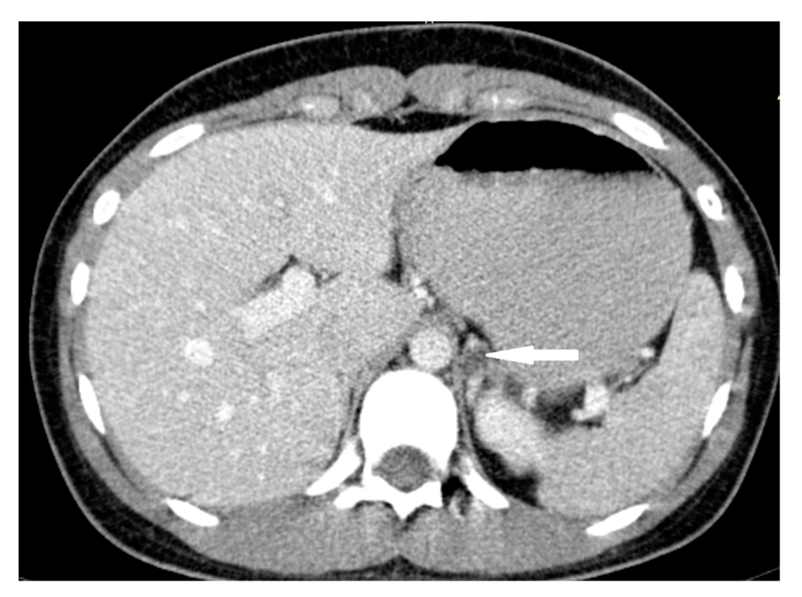 Medicina 58 00746 g007