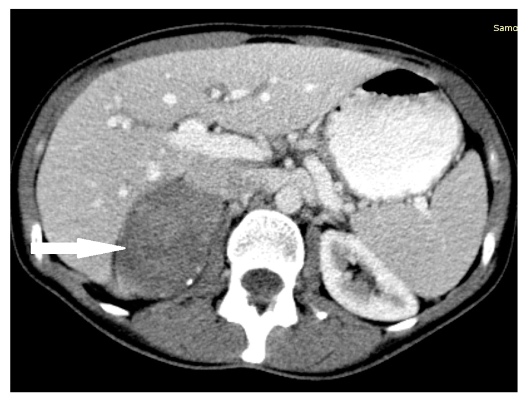 Medicina 58 00746 g010