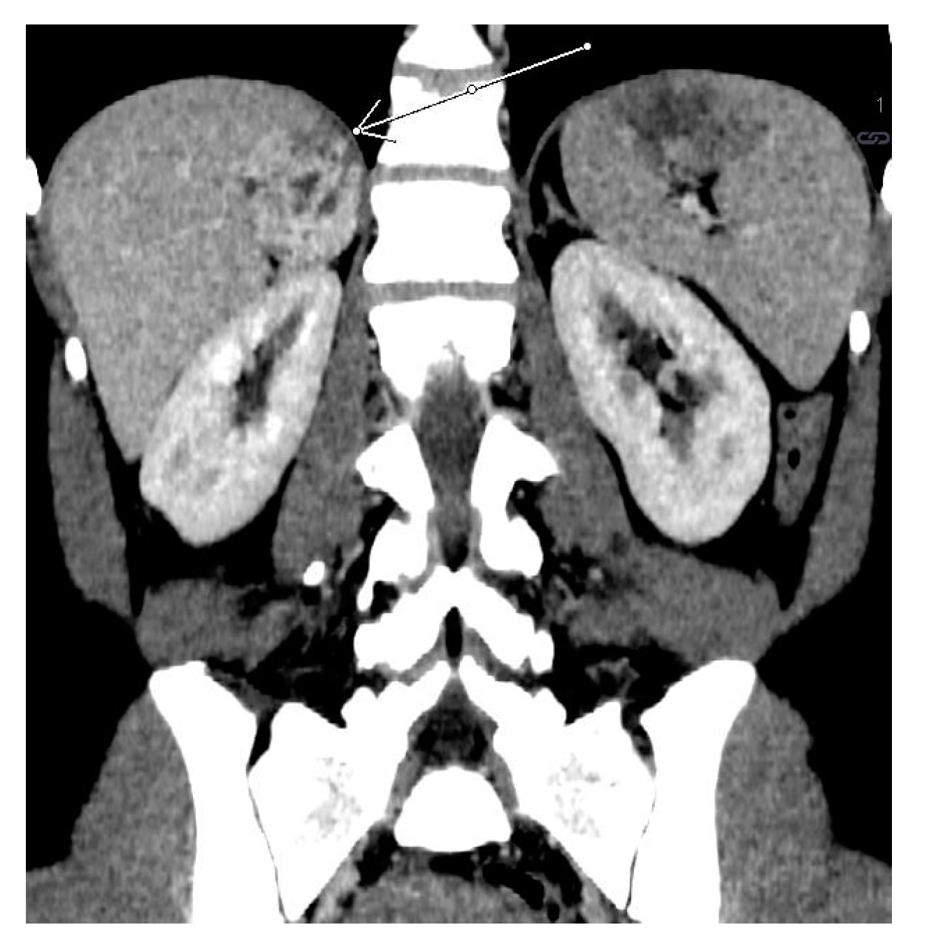 Medicina 58 00746 g012