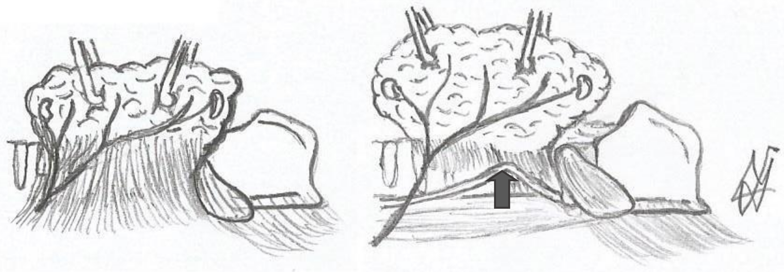 Medicina 58 00755 g011