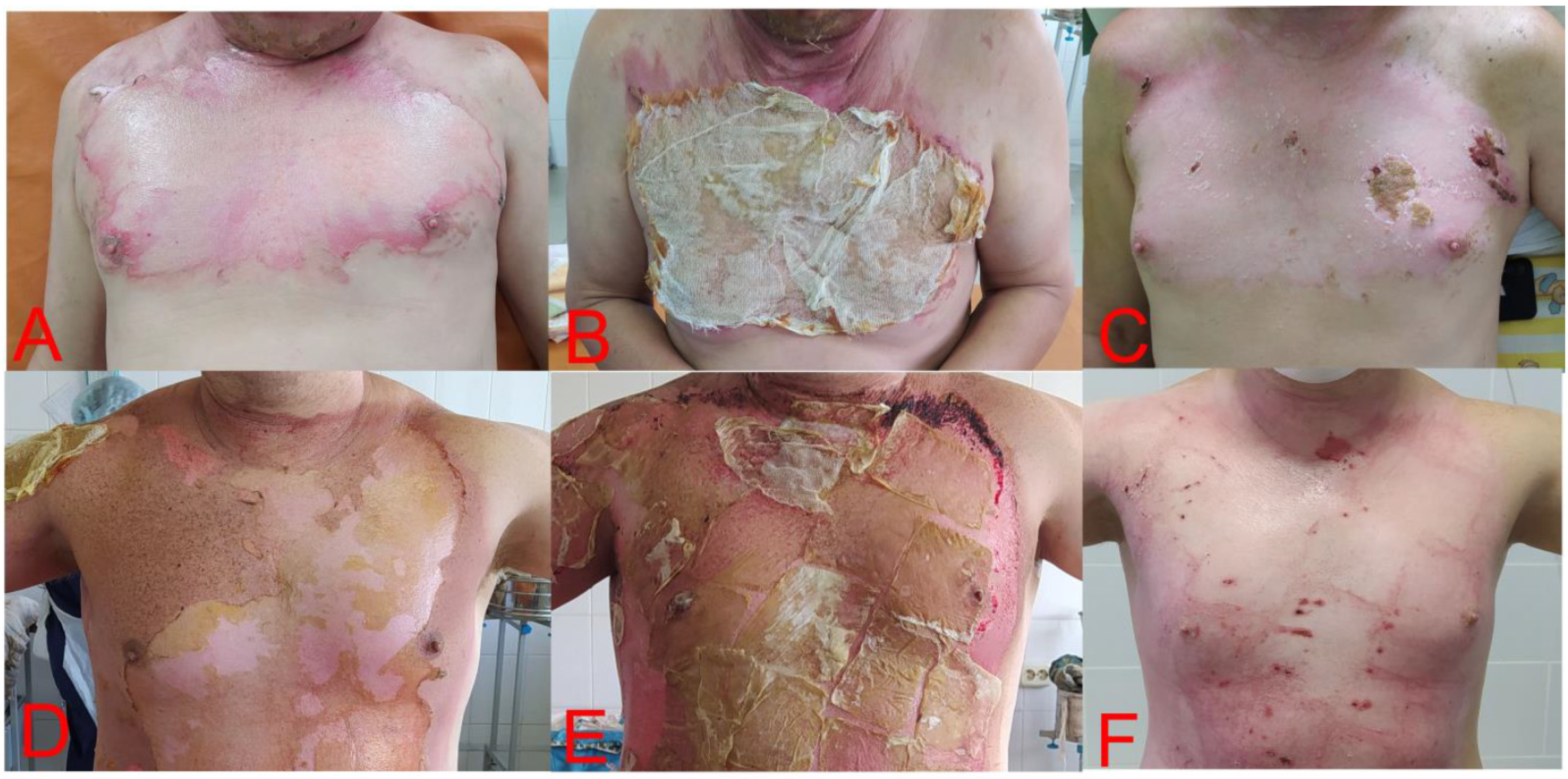 Medicina 58 00819 g002