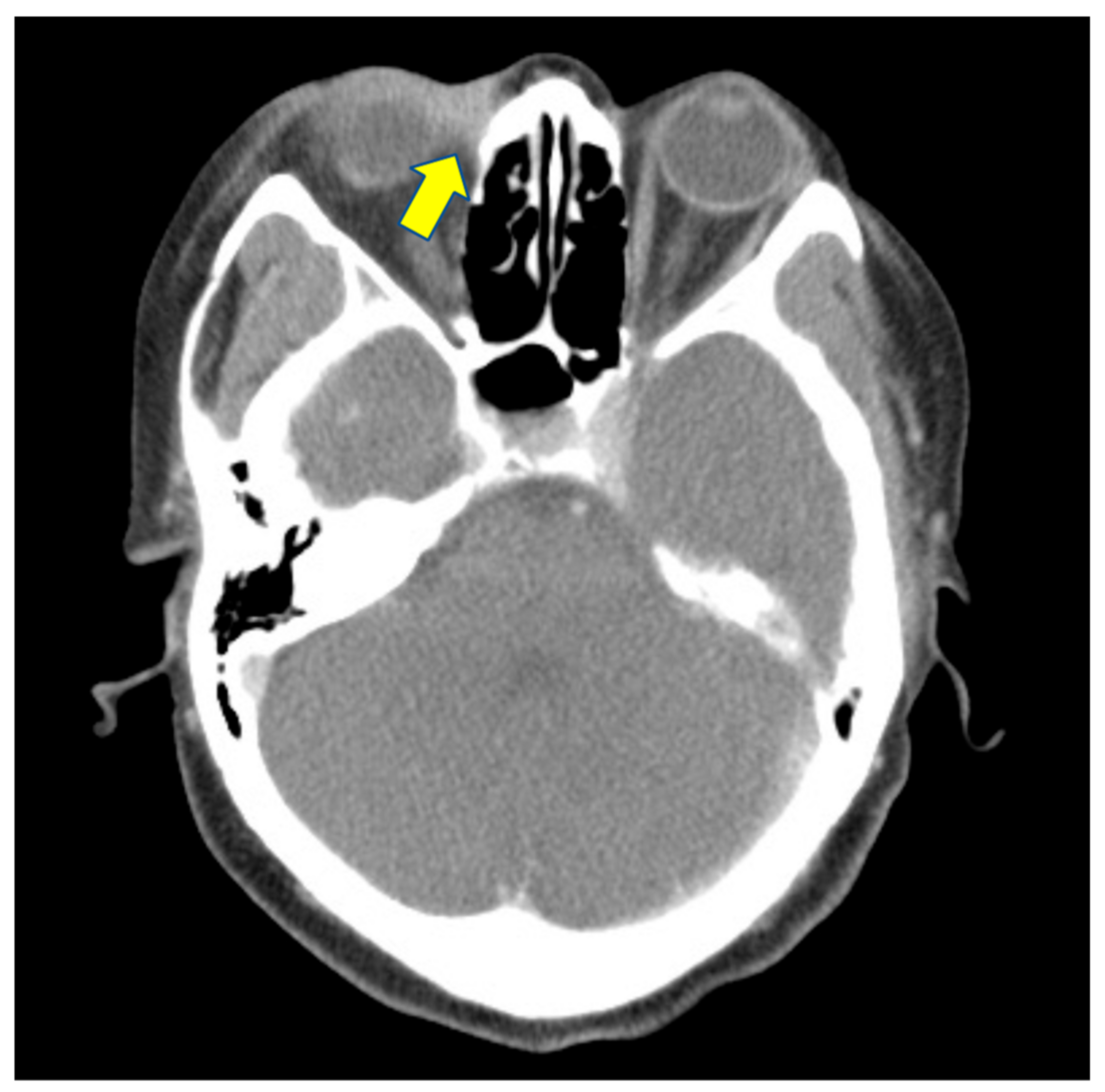 Medicina 58 00846 g002