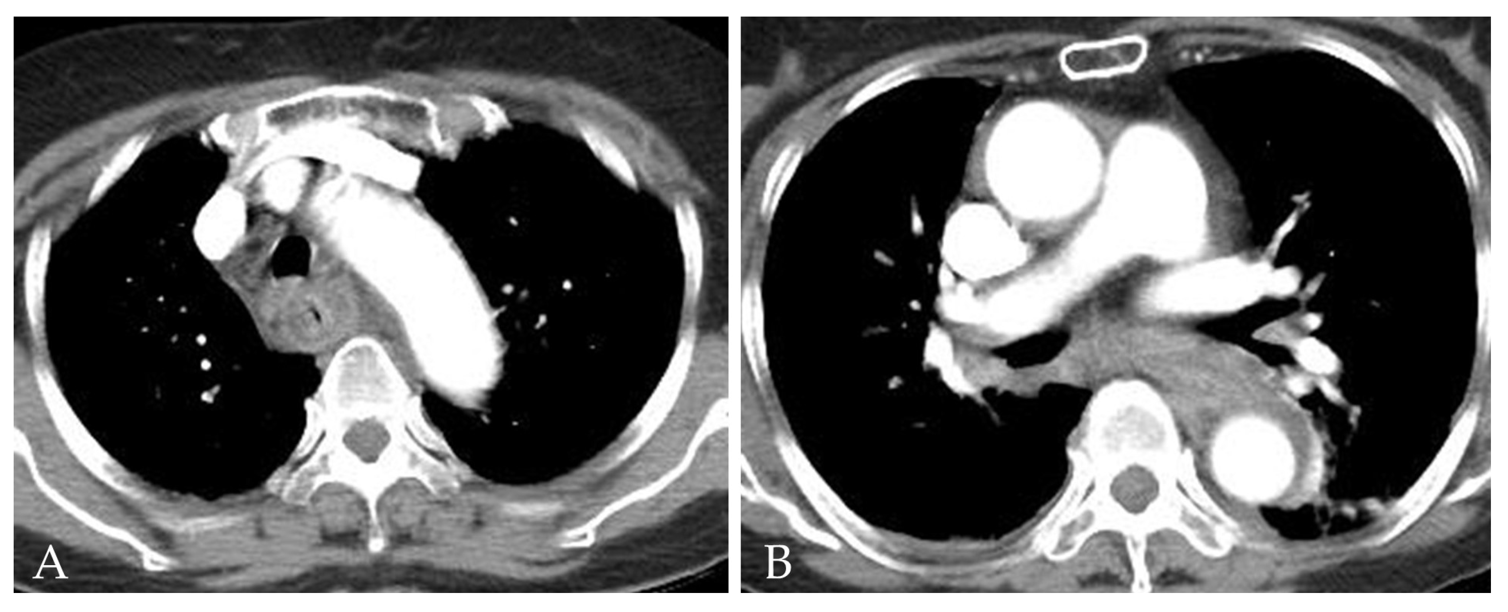 Medicina 58 00864 g001