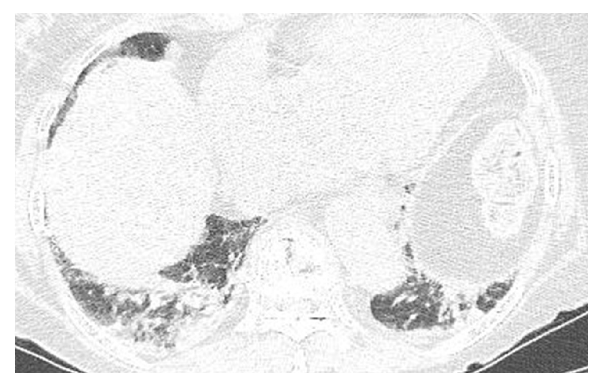 Medicina 58 00864 g002