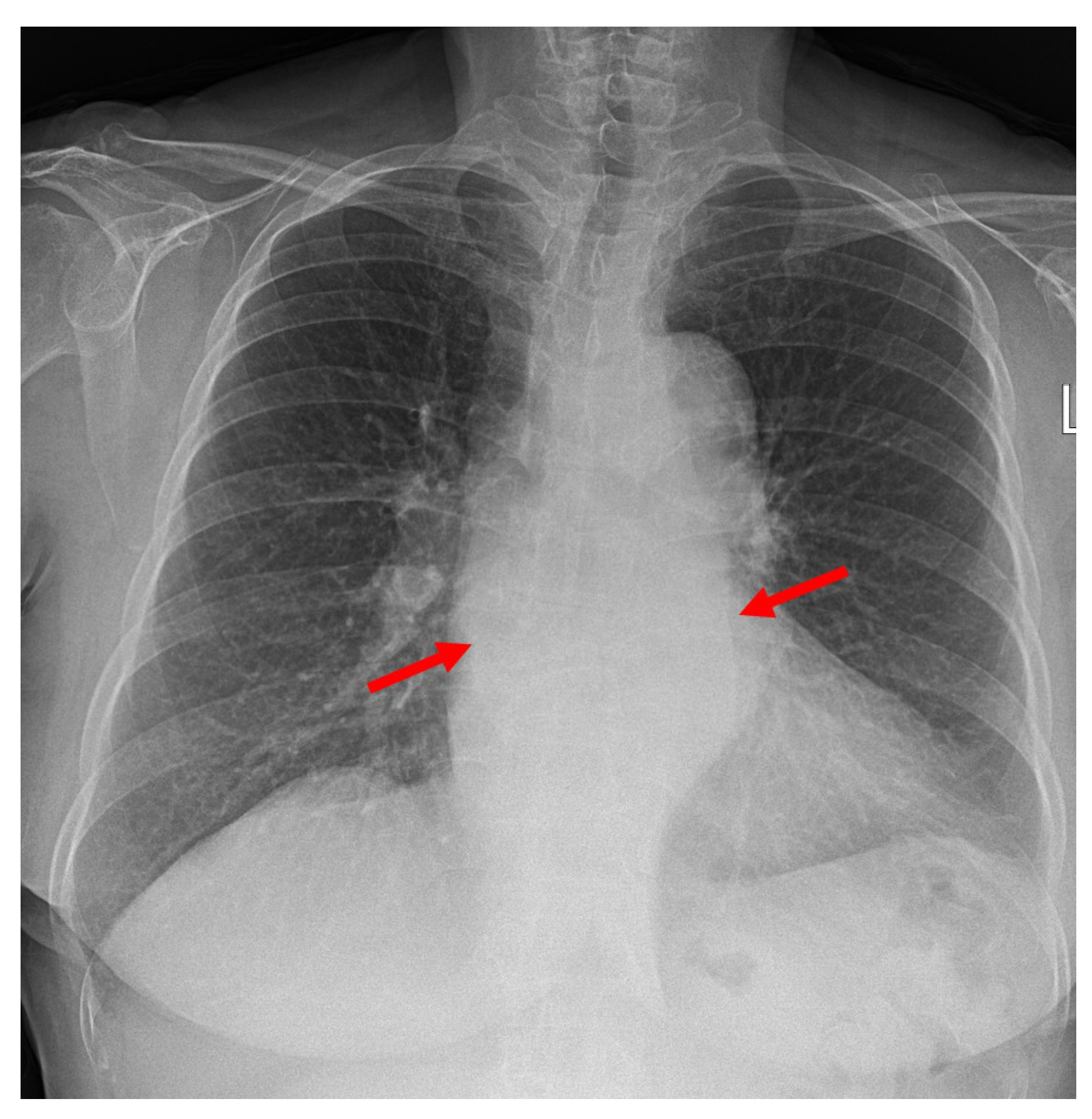 Medicina 58 00864 g003