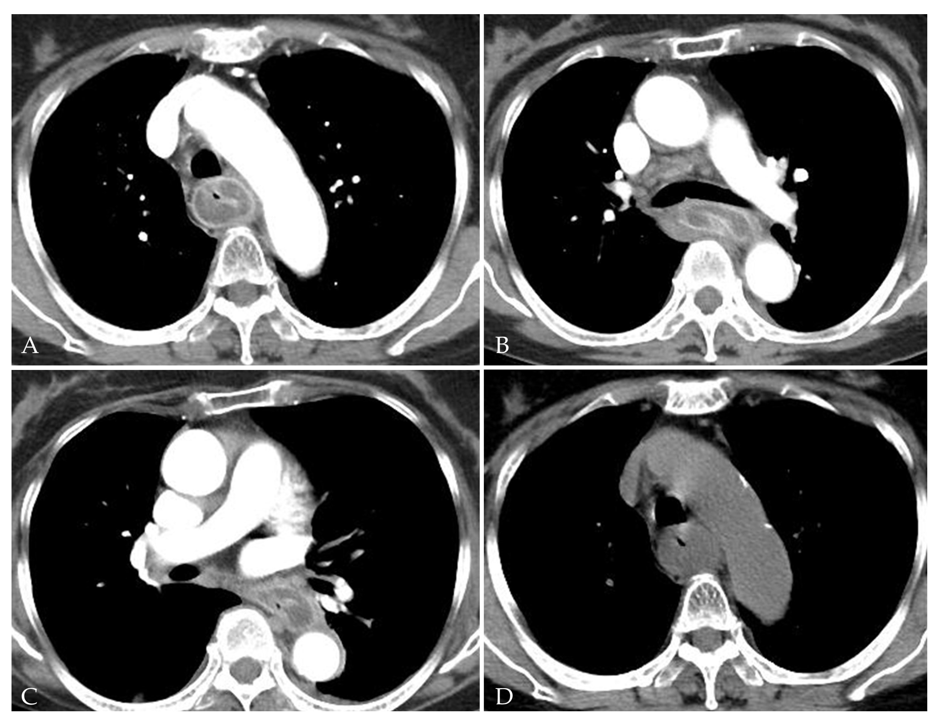 Medicina 58 00864 g004