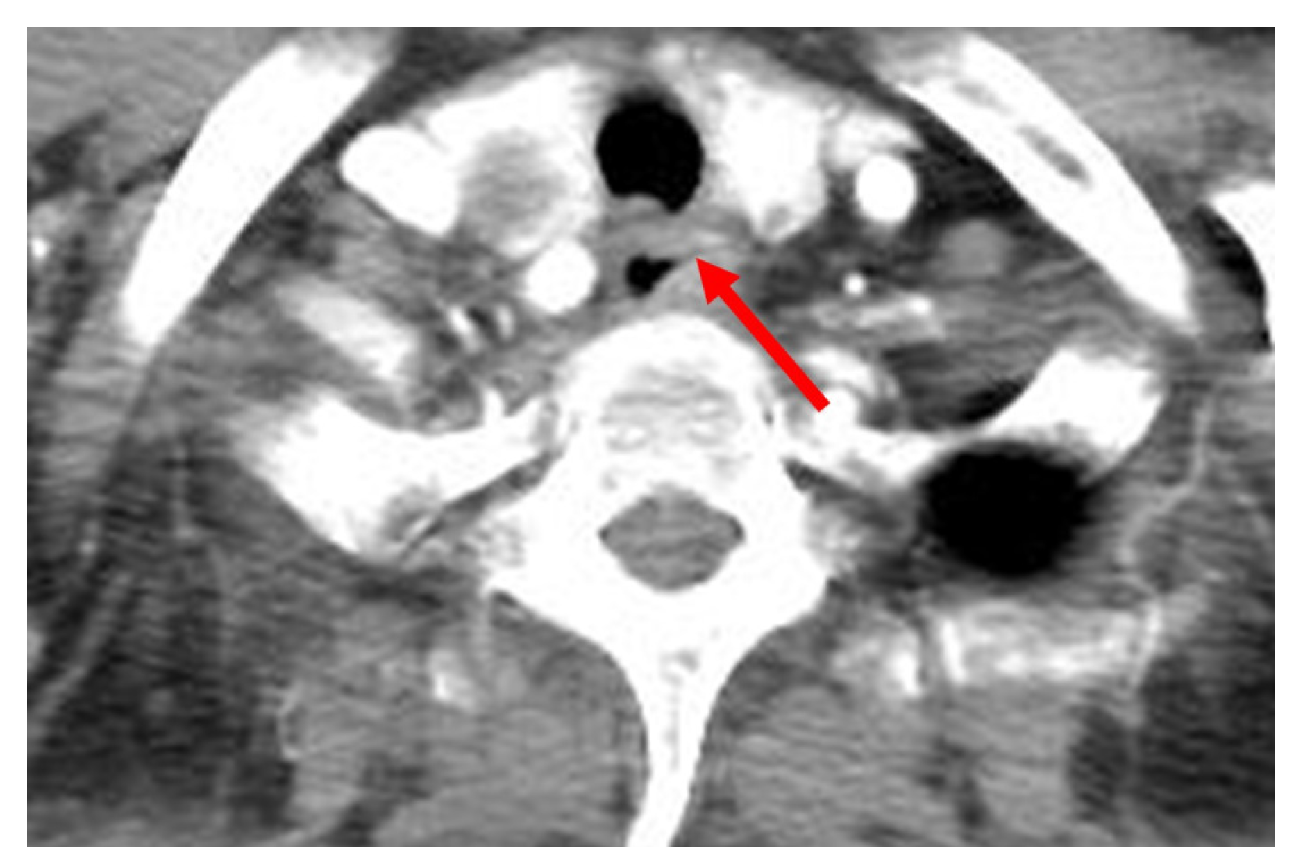 Medicina 58 00864 g005