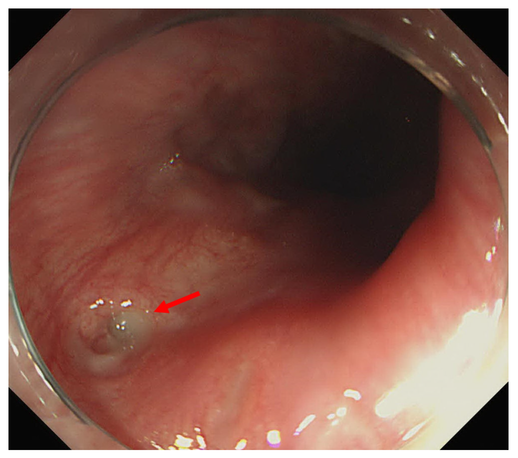 Medicina 58 00864 g006