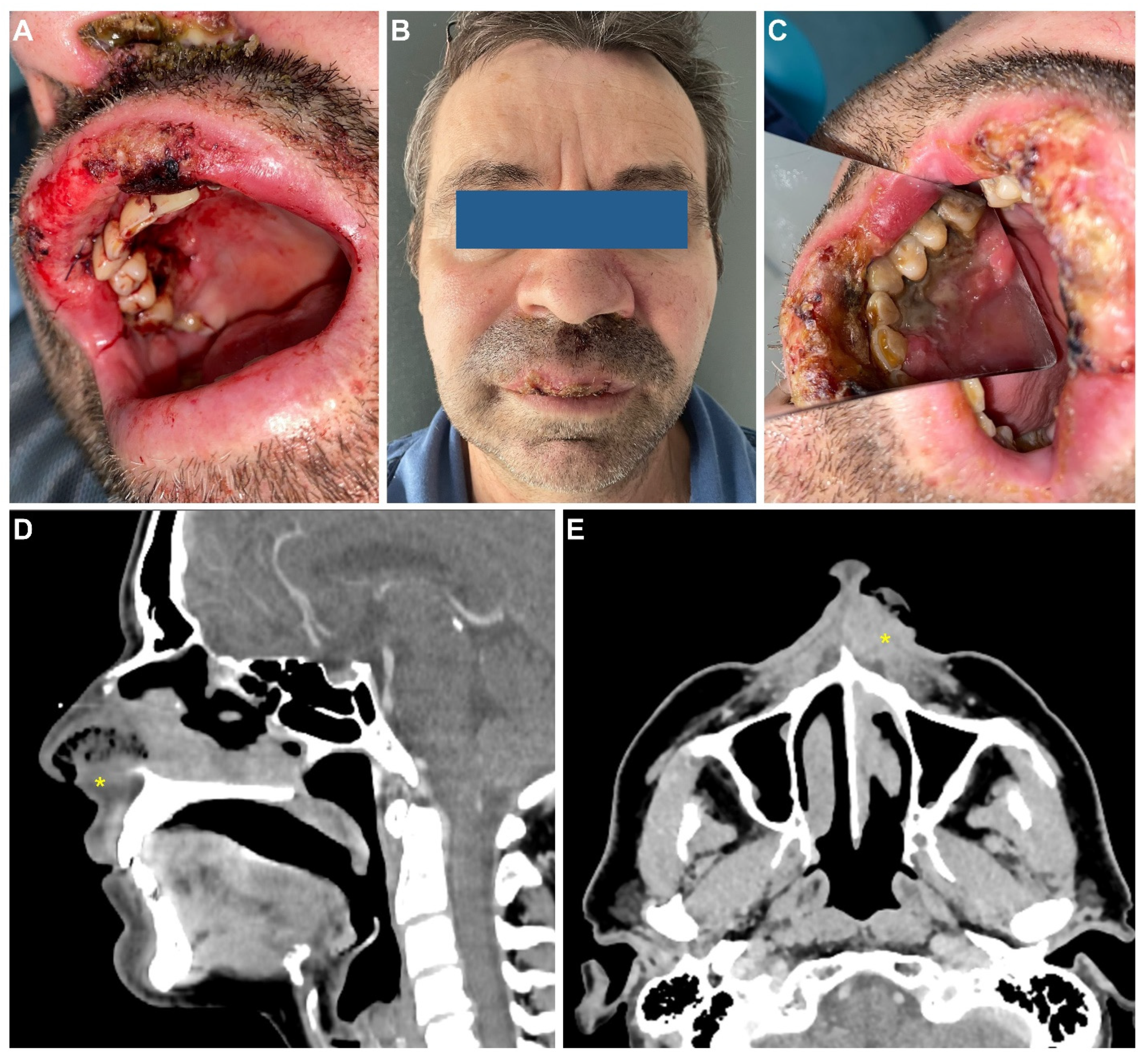 Medicina 58 00874 g003