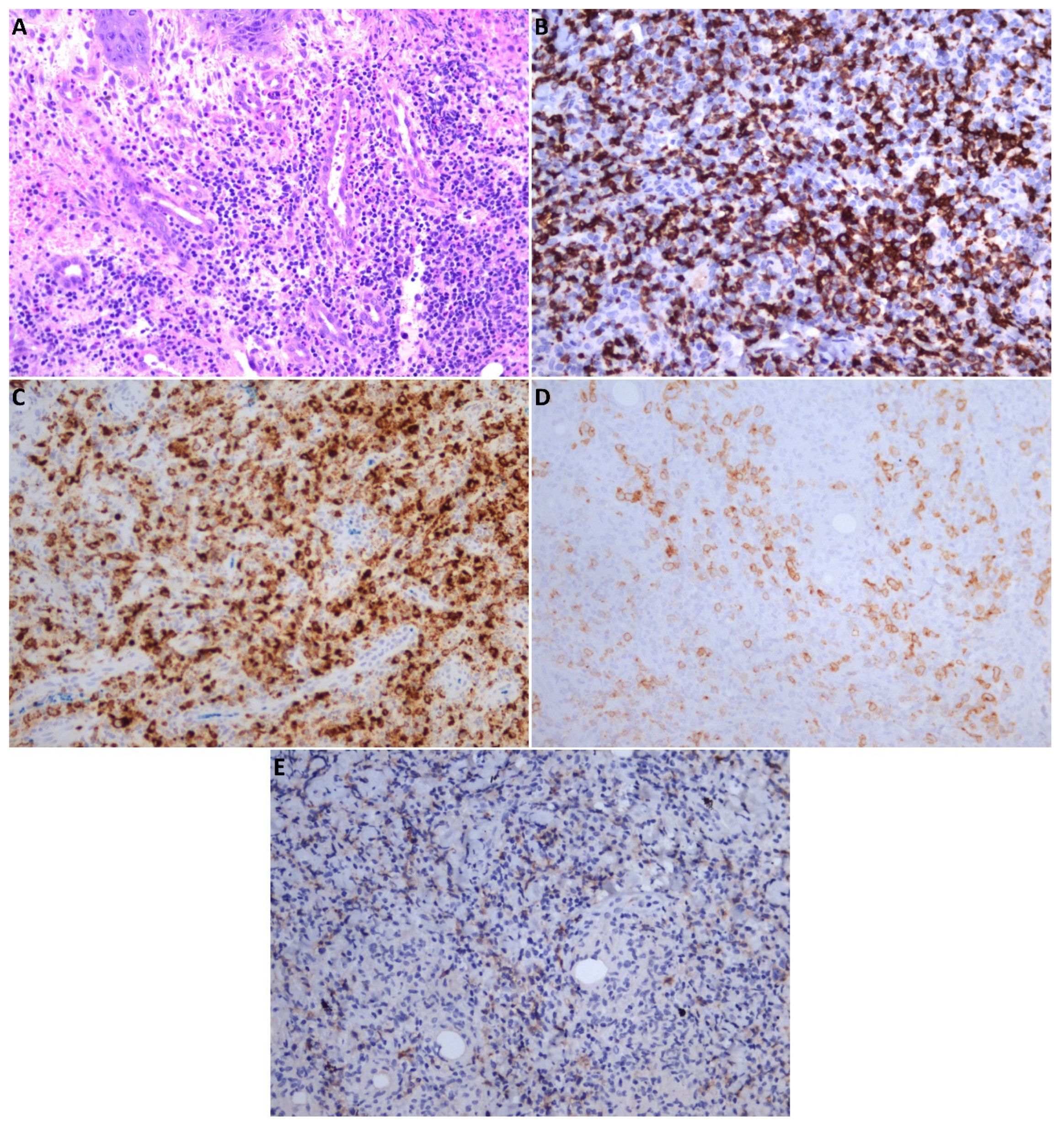 Medicina 58 00874 g004